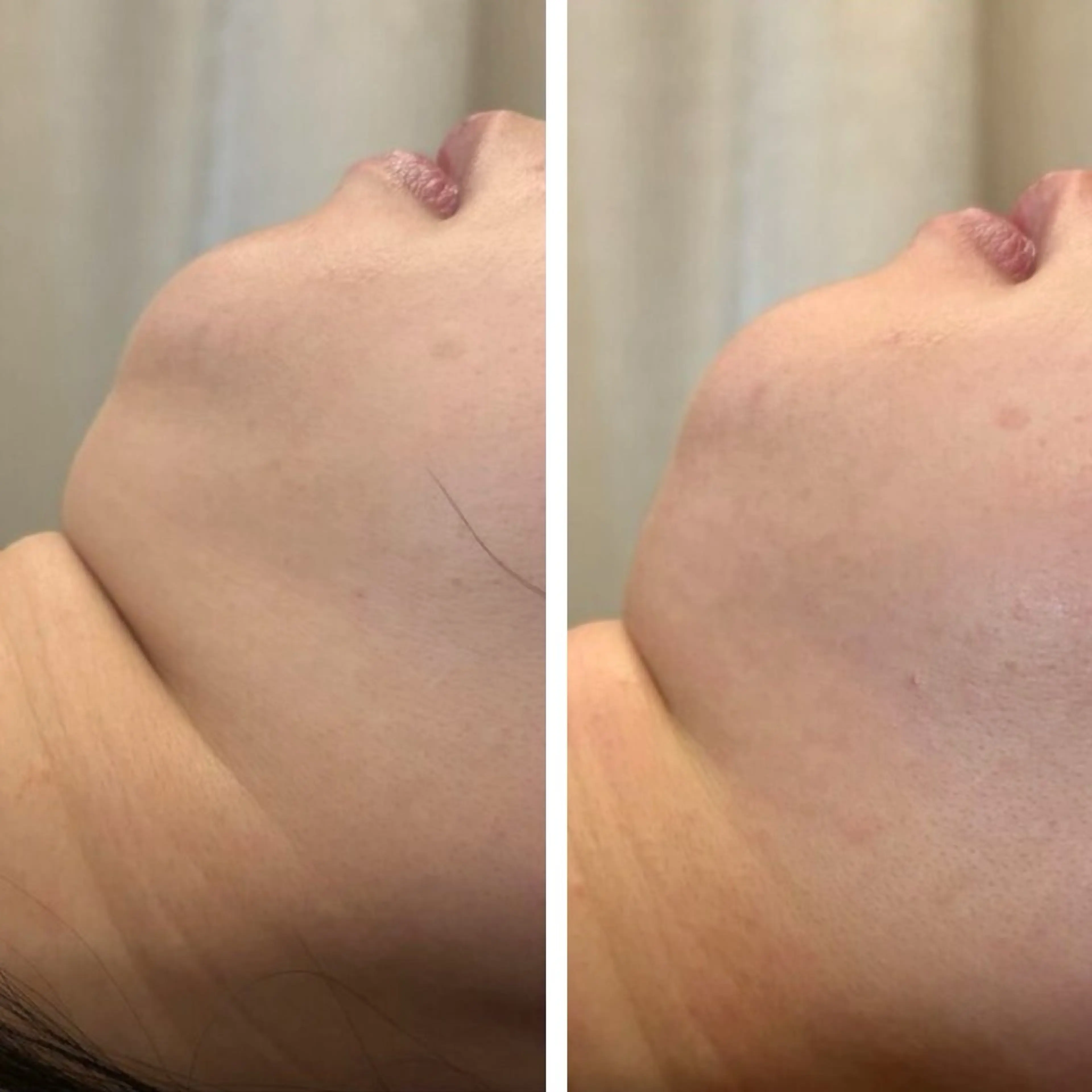 エステ シミケア専門サロンLICCO’S所属・シミケア専門サロン LICCO’S岡崎のエステ・リラクイメージ