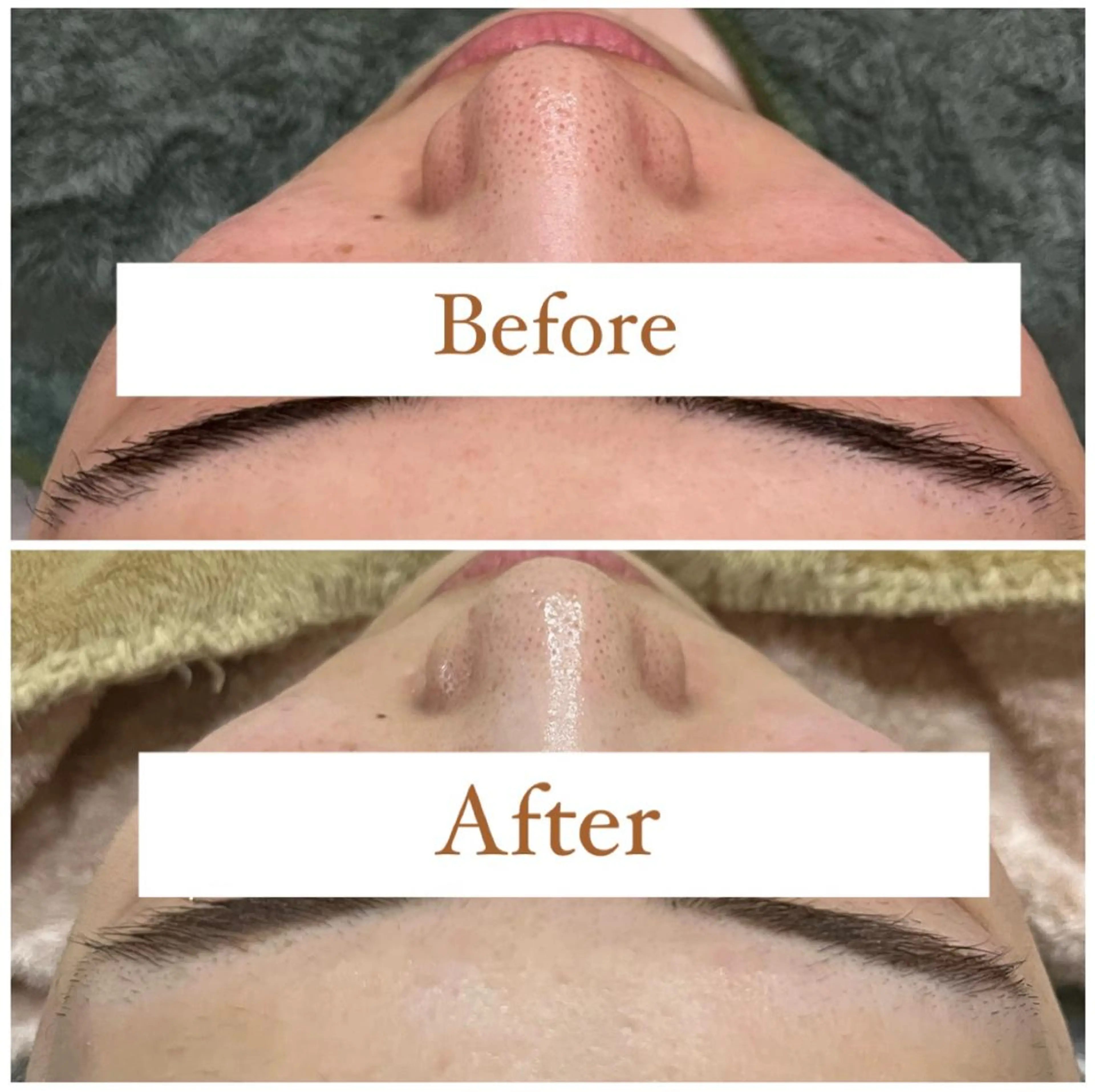 ハーブピーリング専門 muro.のエステ・リラクイメージ