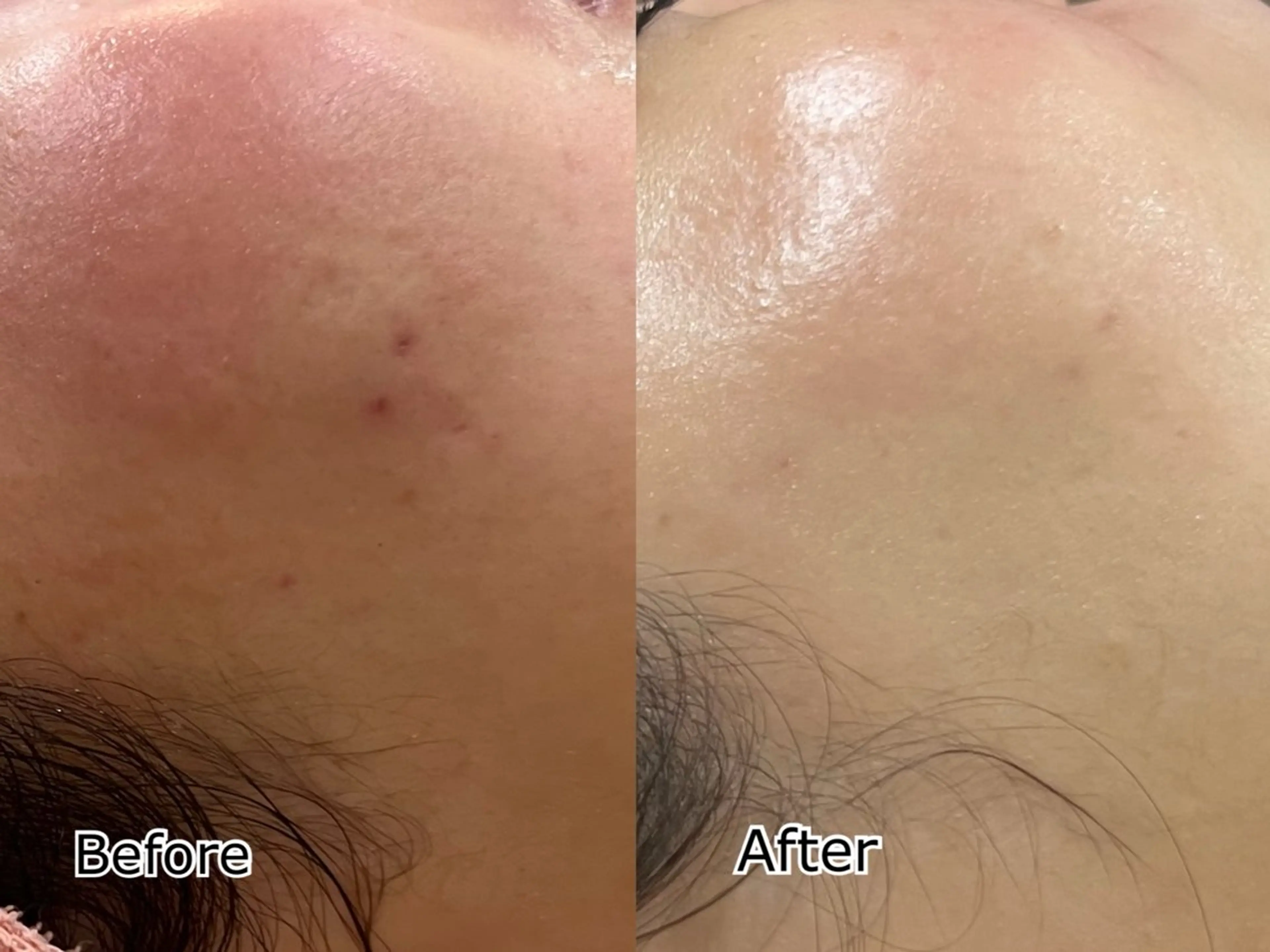 フェイシャル/脱毛 ジョアアンジェ竹田のエステ・リラクイメージ