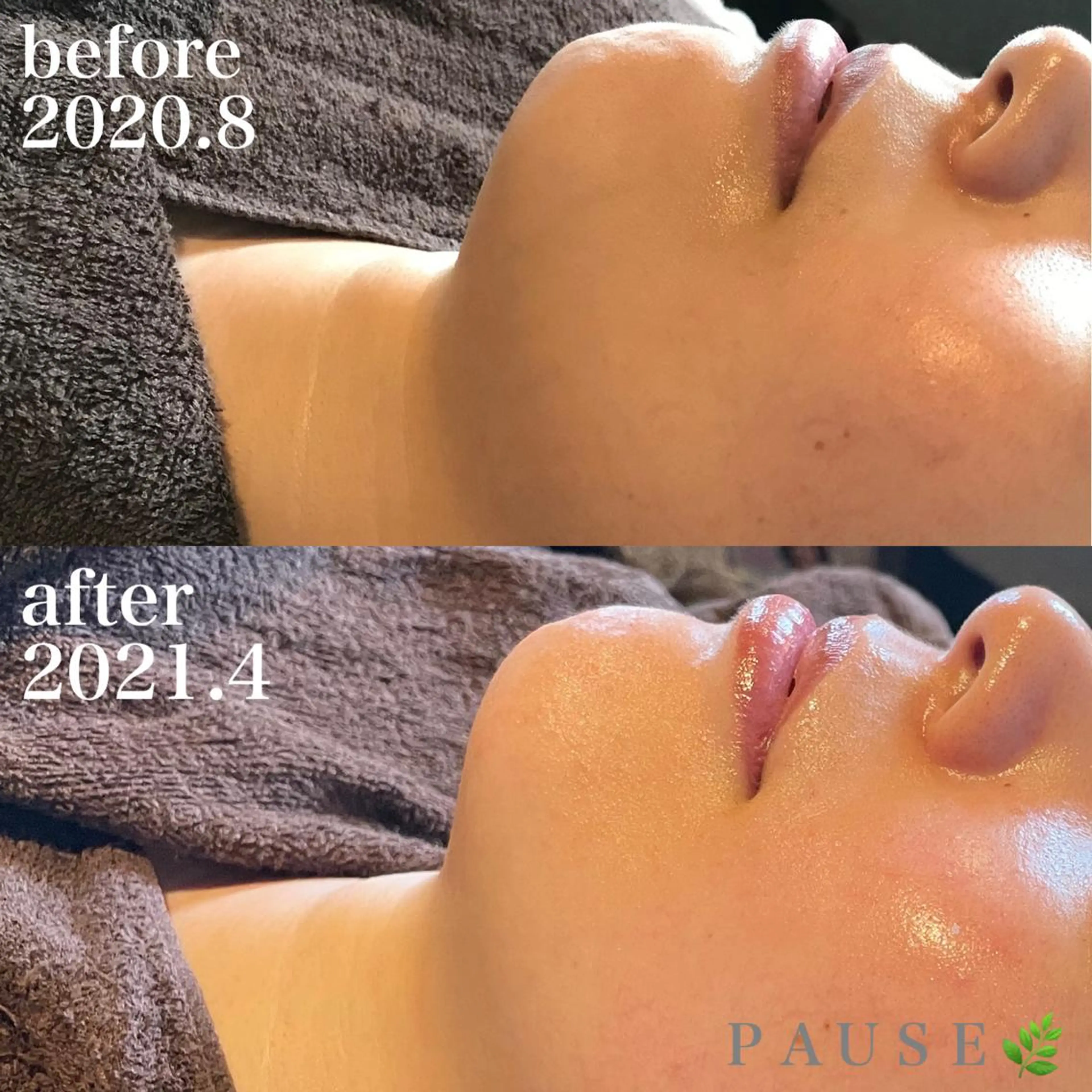 エステ 浜野 恵美のエステ・リラクイメージ