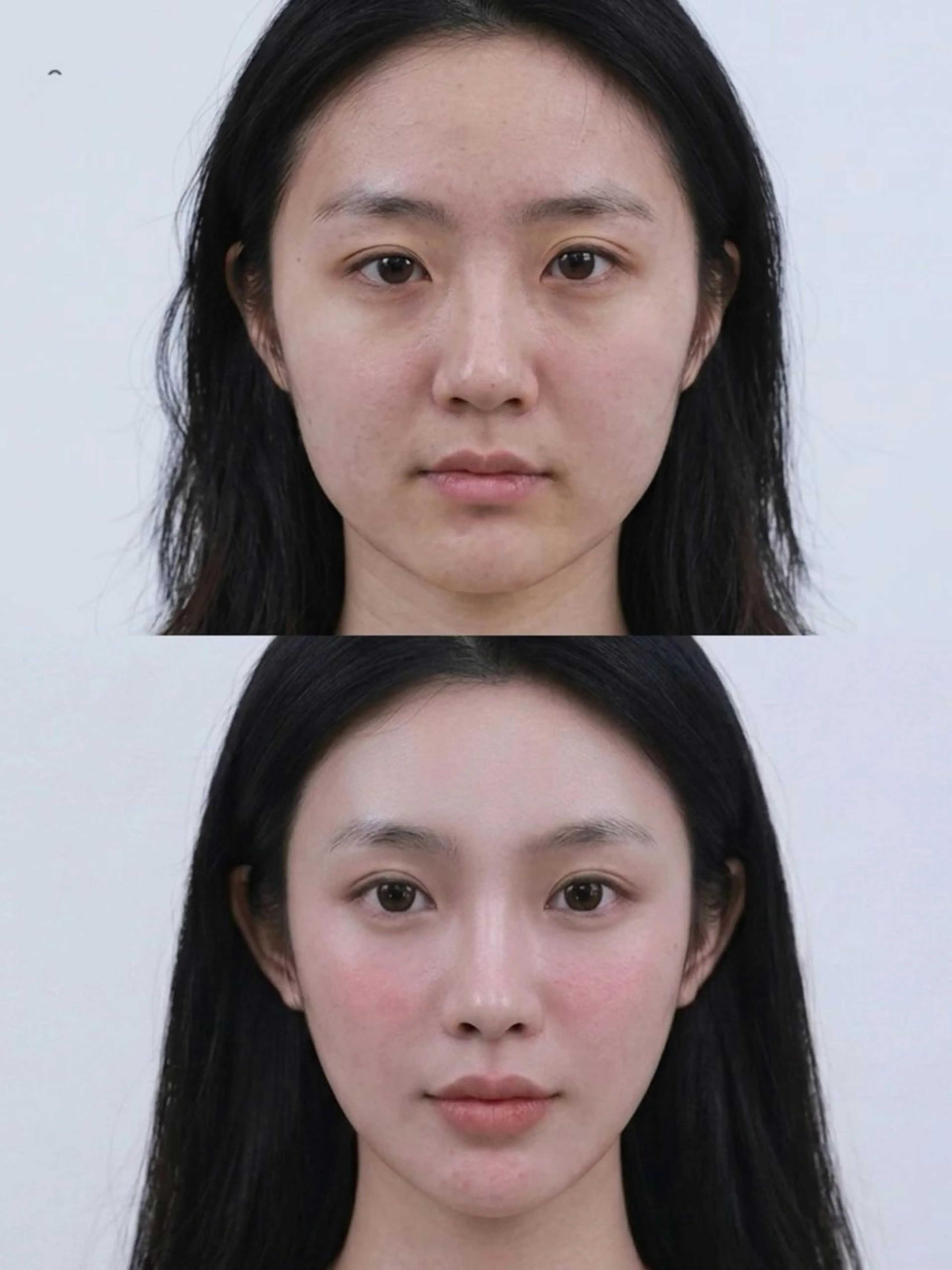 ネイル エステ aliaハイフ&水光ジェットサロン所属・aliaハーブ水光店 エステティシャン募集のエステ・リラクイメージ