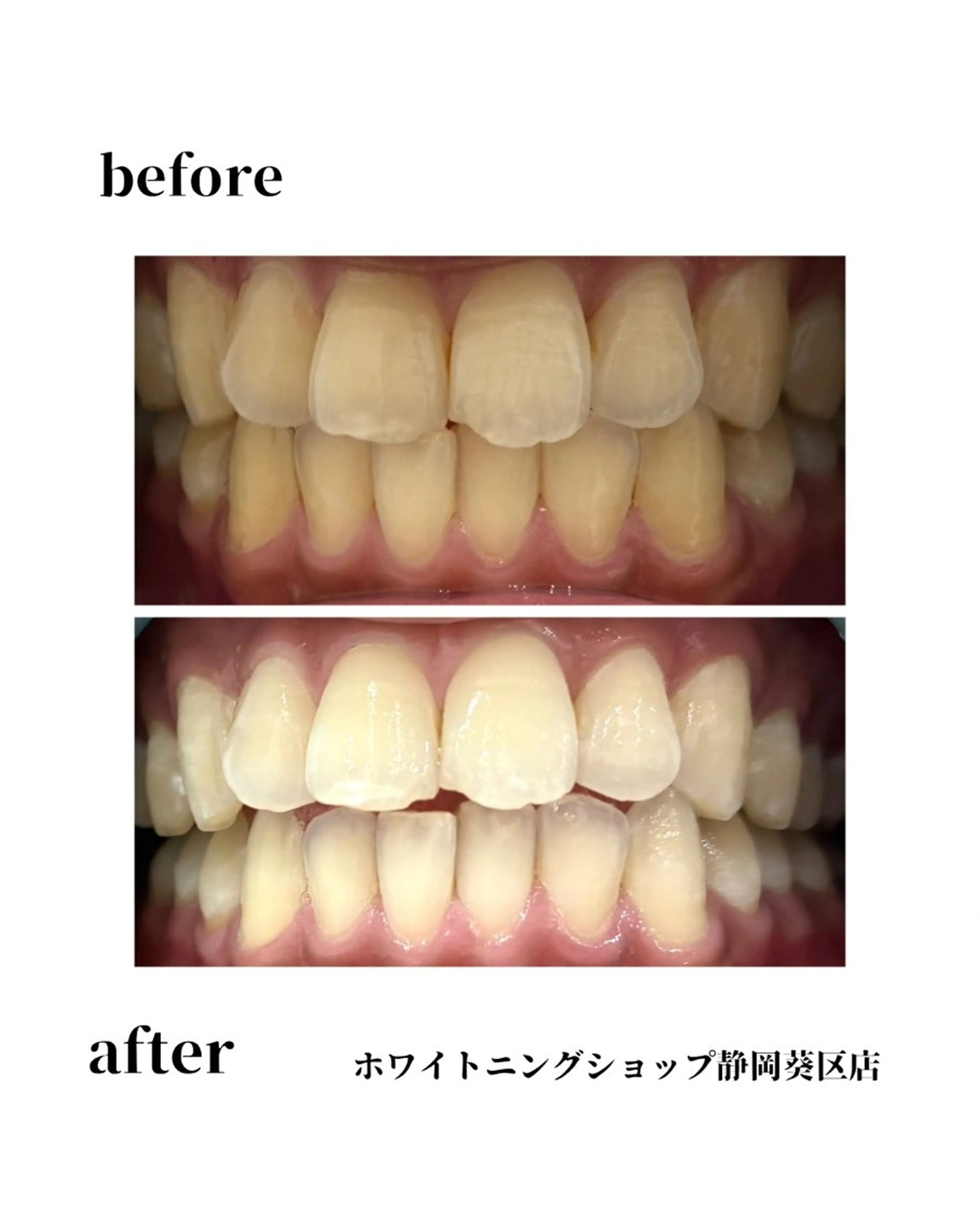 ホワイトニングショップ静岡葵区店所属・ホワイトニング ショップ葵区静岡駅店のその他イメージ