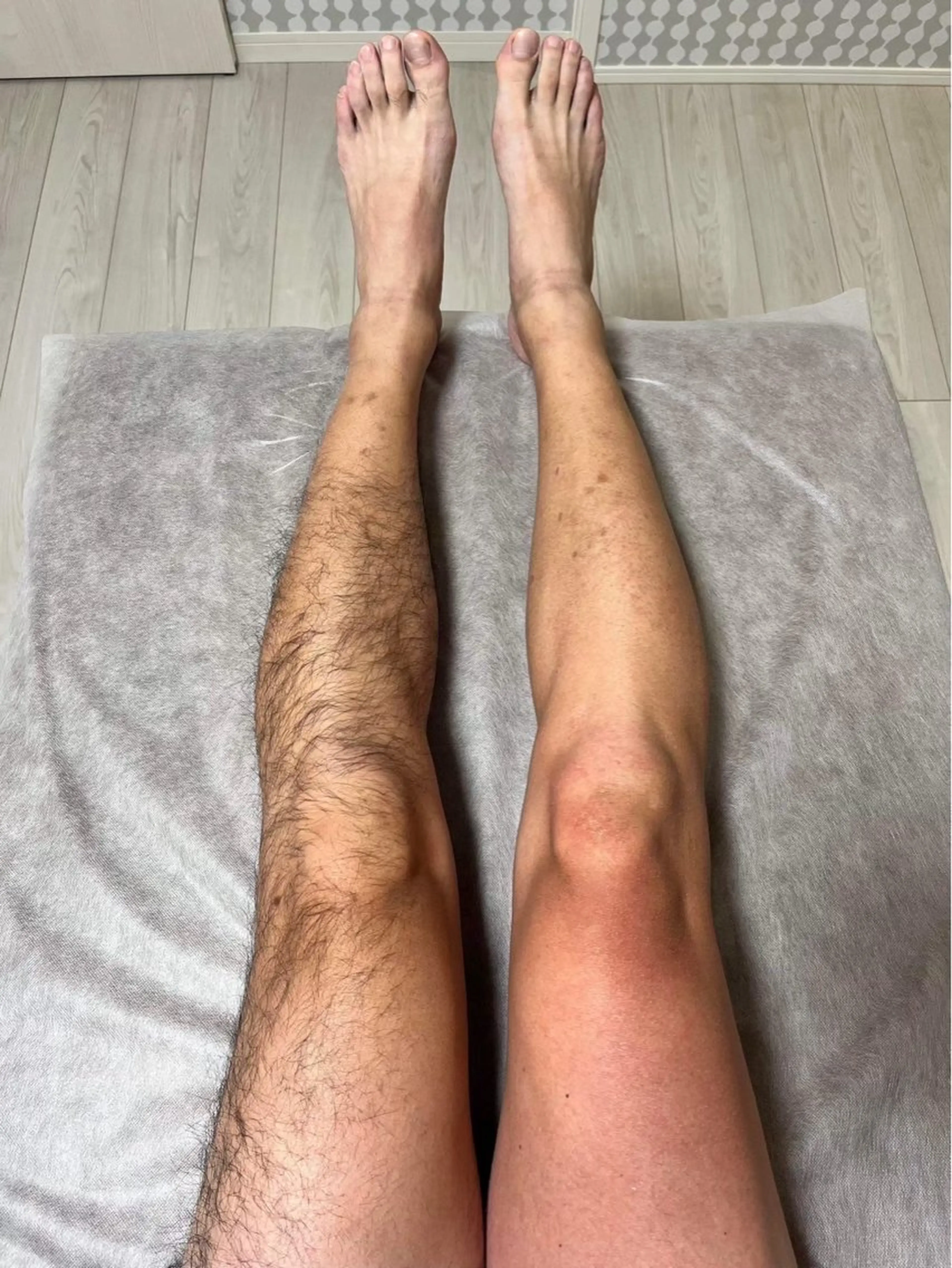 男性限定🉐足ワックス脱毛の写真