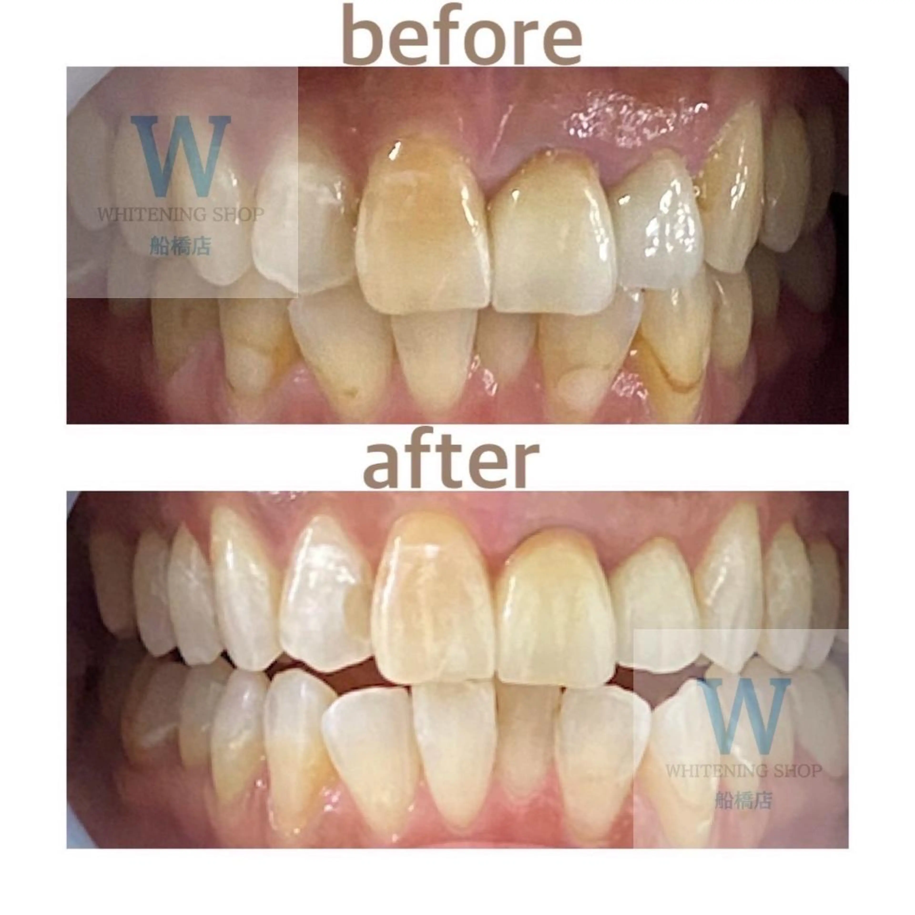 エステ リラク ホワイトニング ショップ船橋２号店のエステ・リラクイメージ