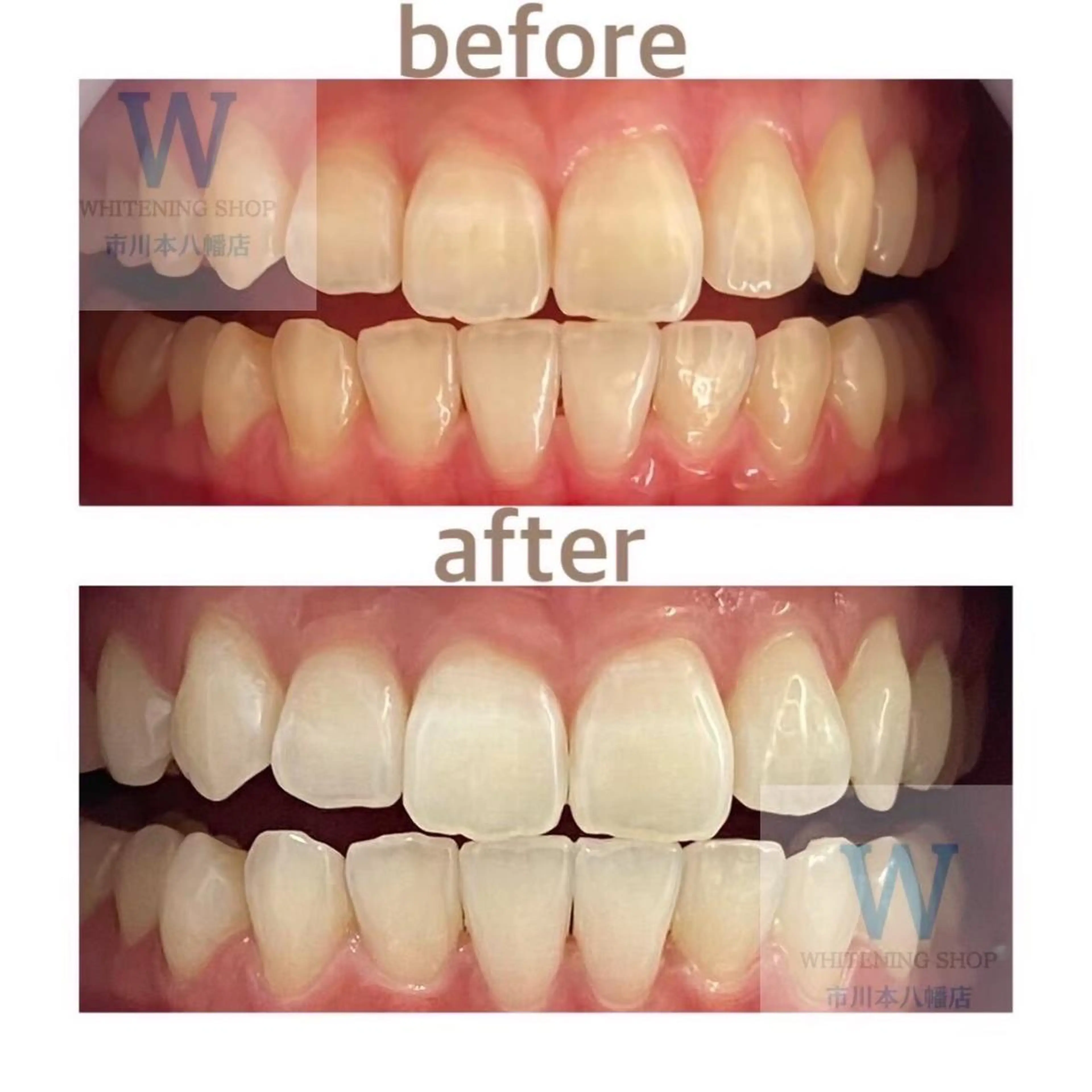 ホワイトニング ショップ本八幡店のエステ・リラクイメージ