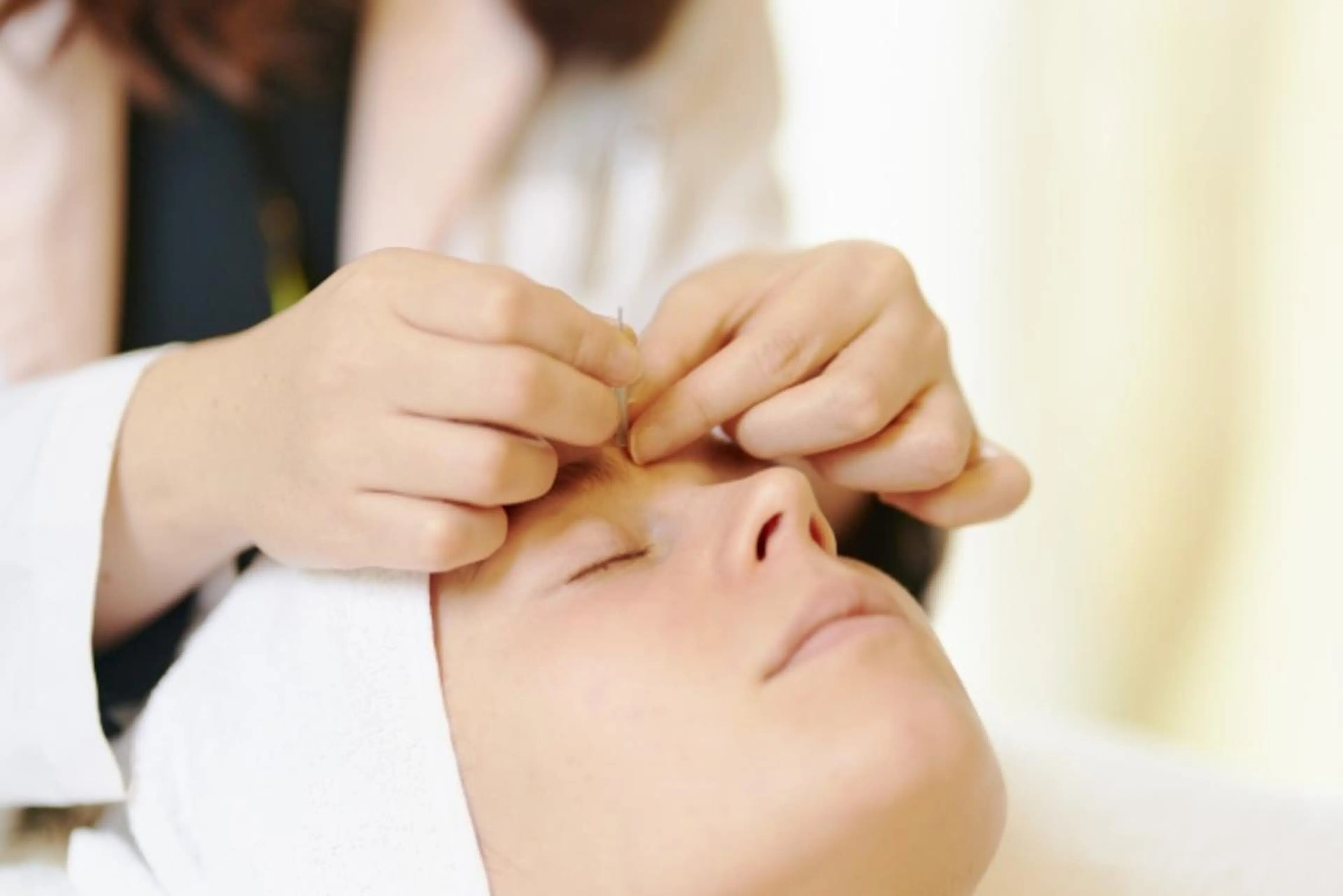 ⭐人気NO.2⭐美容鍼✩.*˚の写真