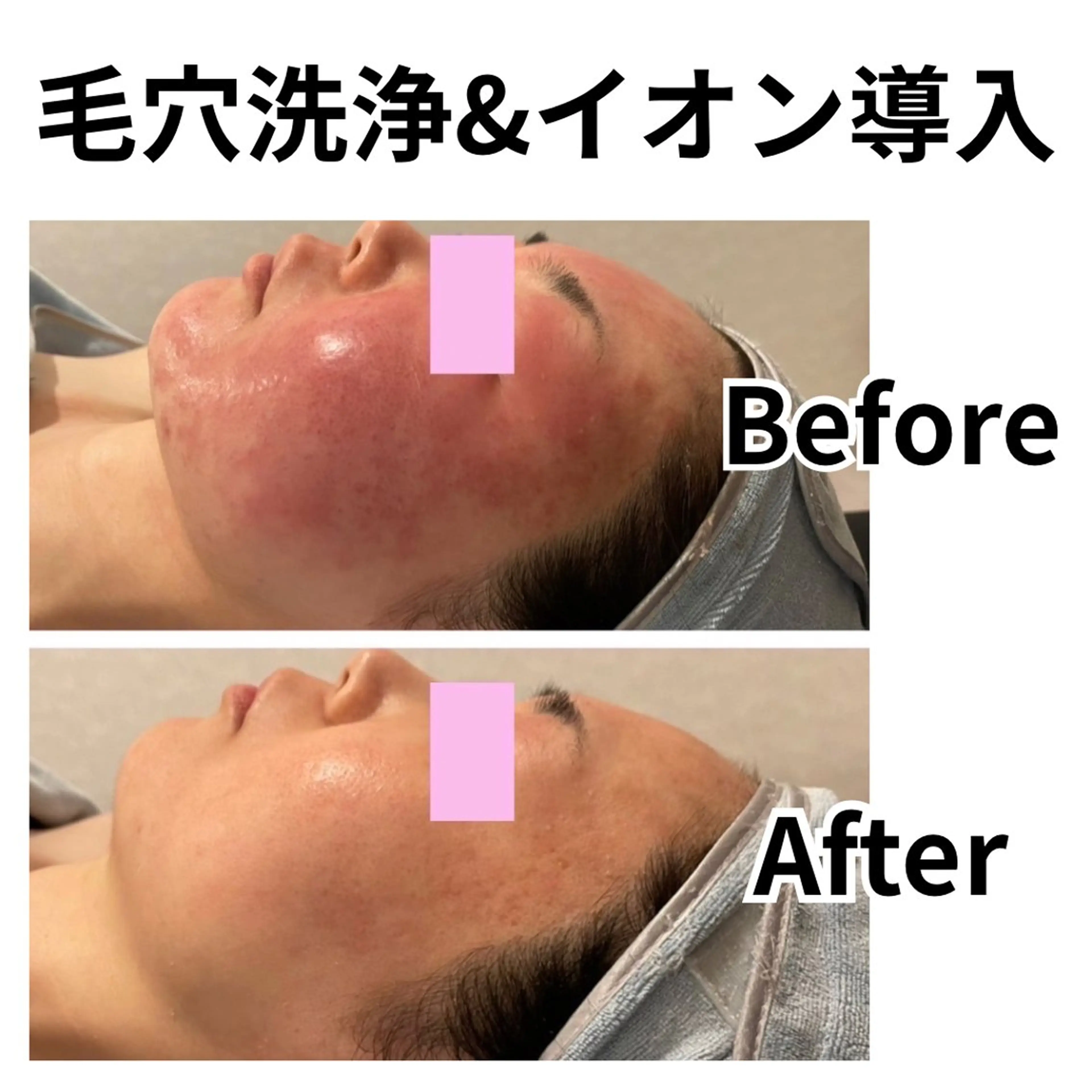 林 陽向のエステ・リラクイメージ