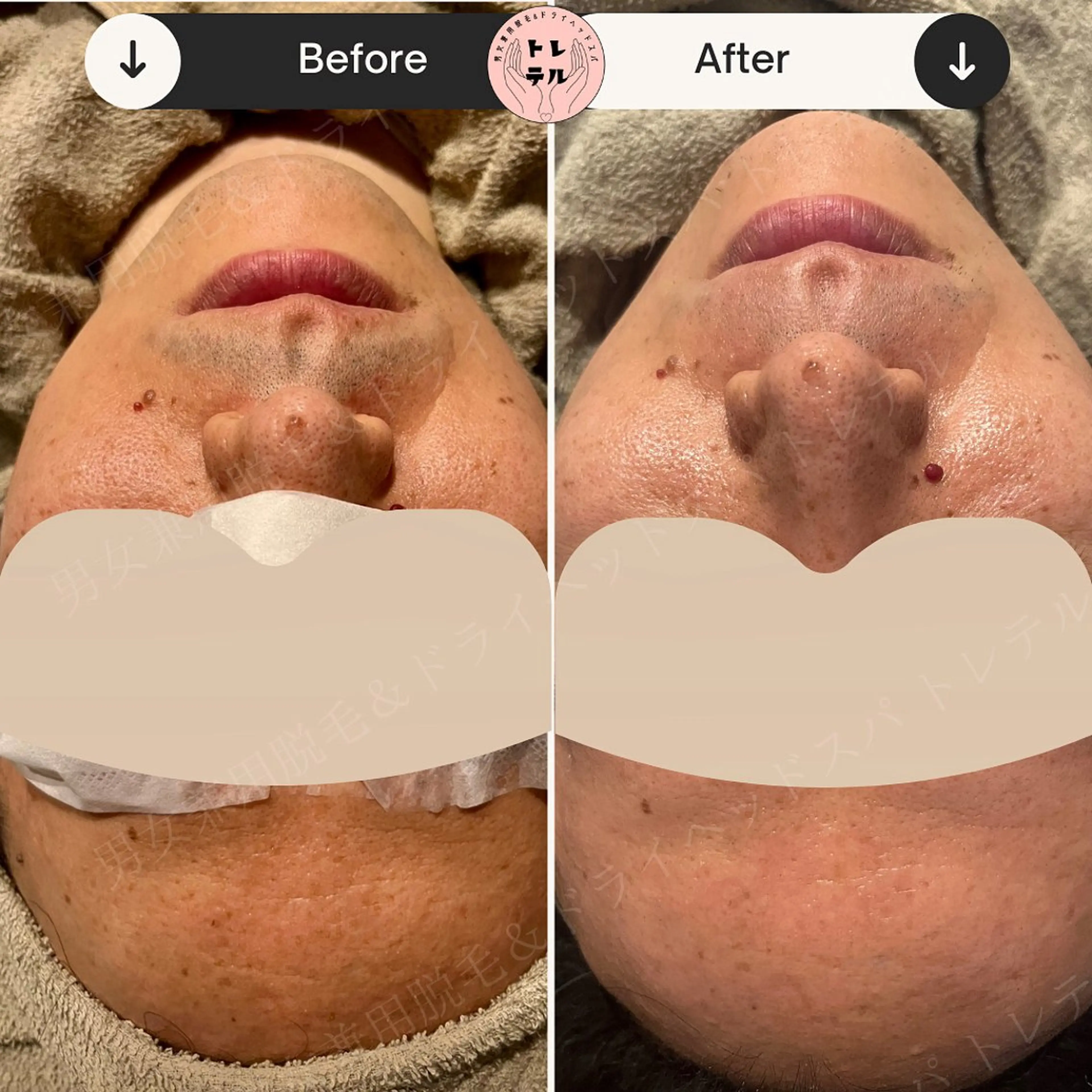 男女兼用脱毛＆ドライ ヘッドスパ トレテルのエステ・リラクイメージ