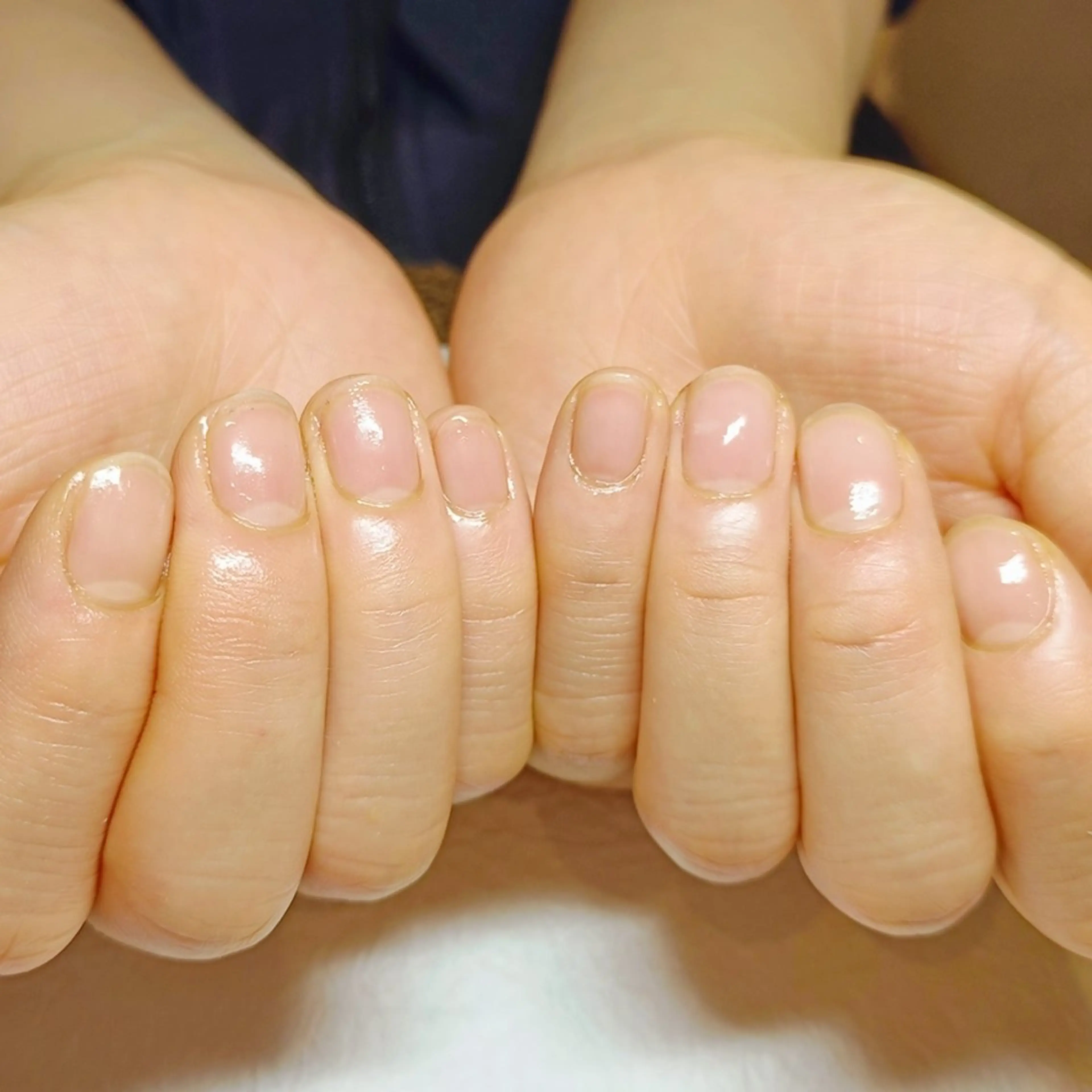 ネイル ハンドネイル ハンドケア 深爪矯正/爪育成ケア manie nailのネイルデザイン