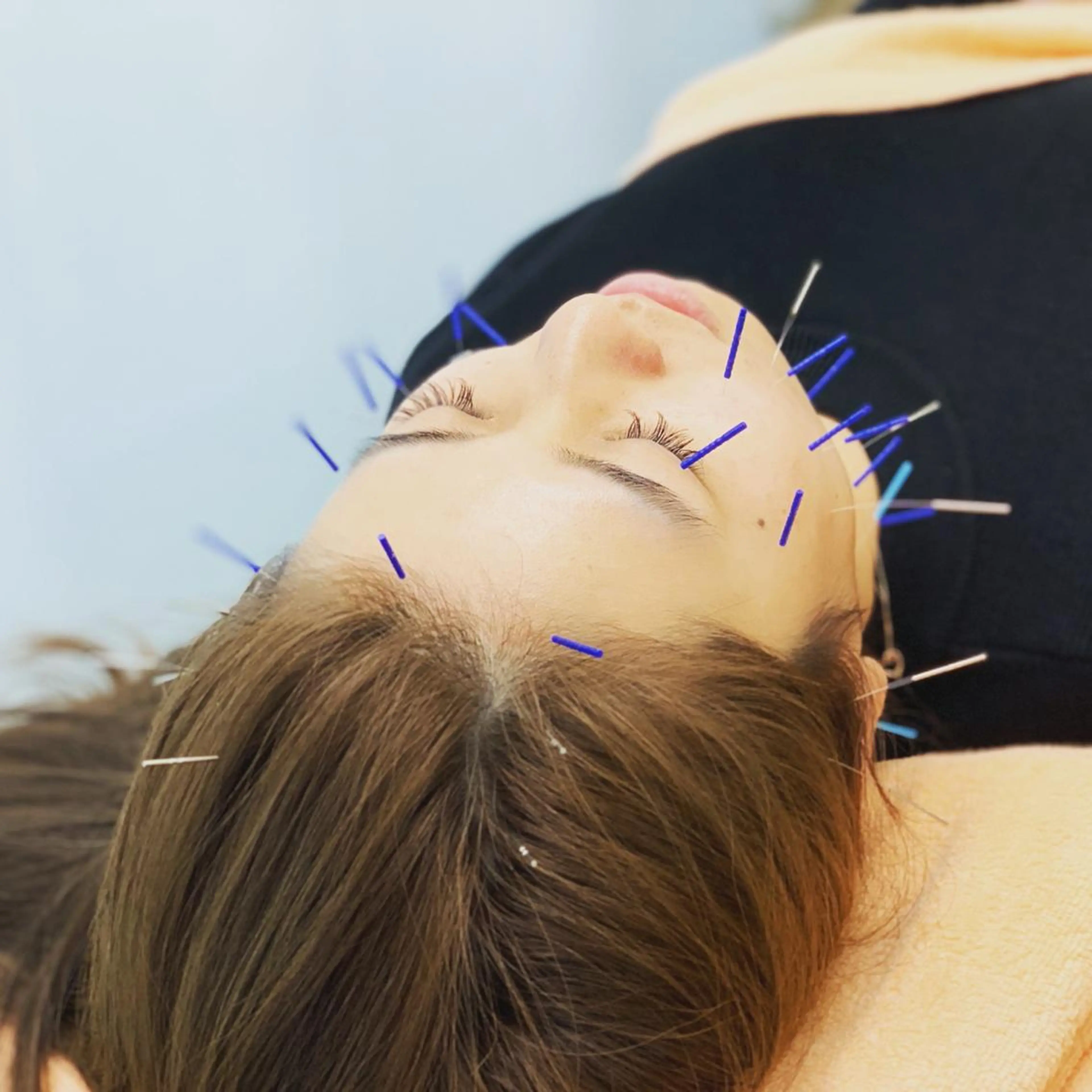 小林整骨院　下総中山所属・津田 龍平のその他イメージ