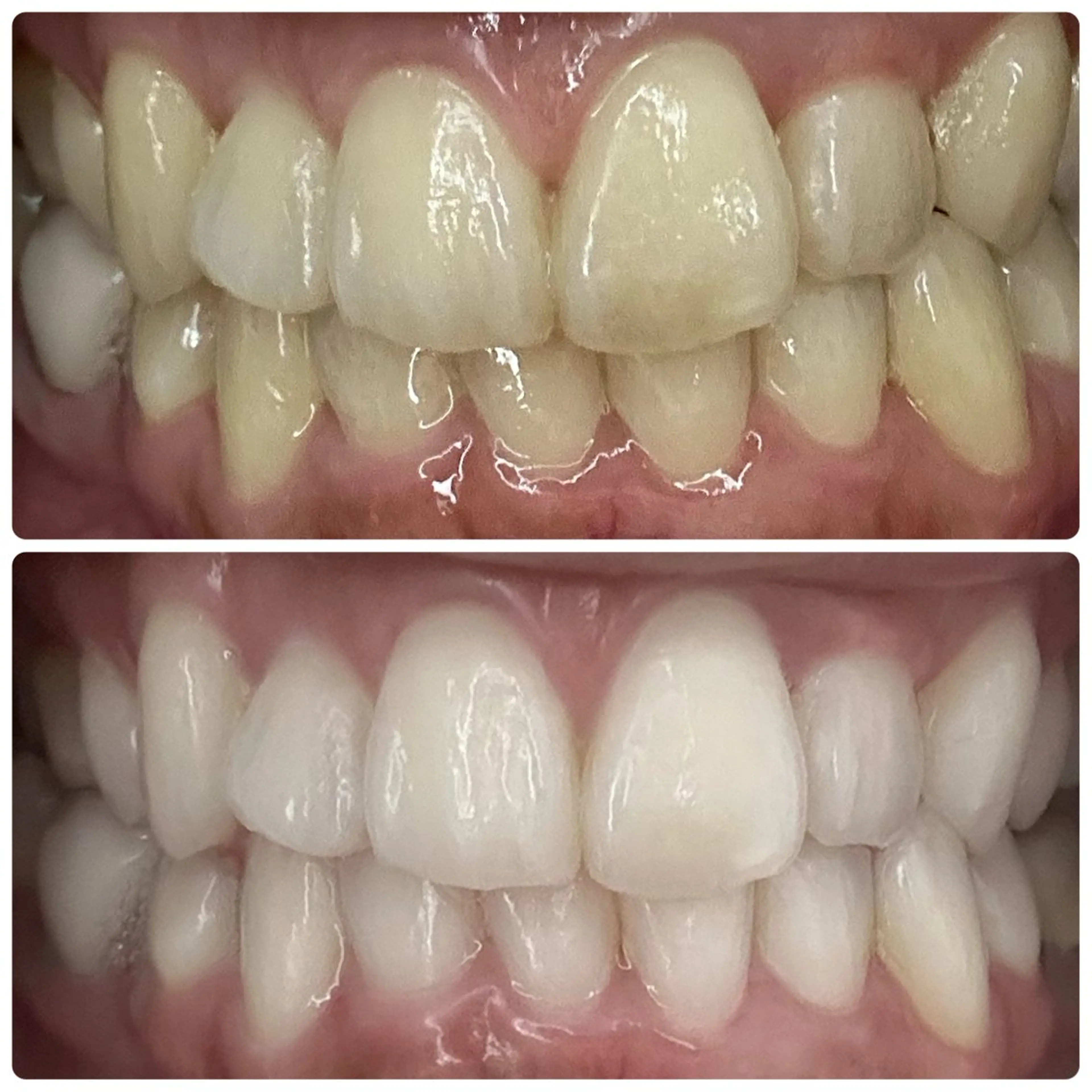 歯のホワイトニング専門店＆white所属・歯のホワイトニング 専門店&whiteのその他イメージ