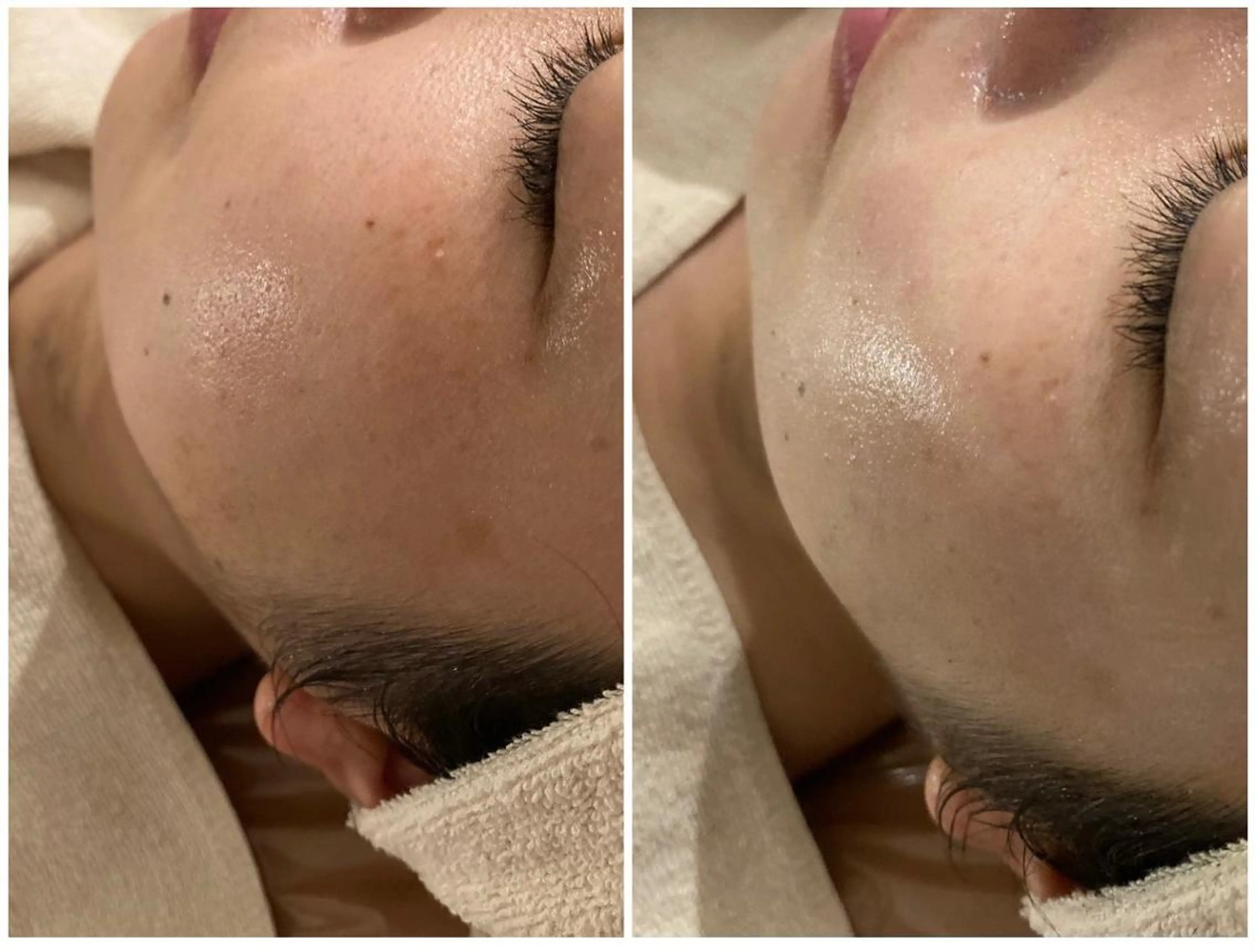 エステfreep takamoriのエステ・リラクイメージ