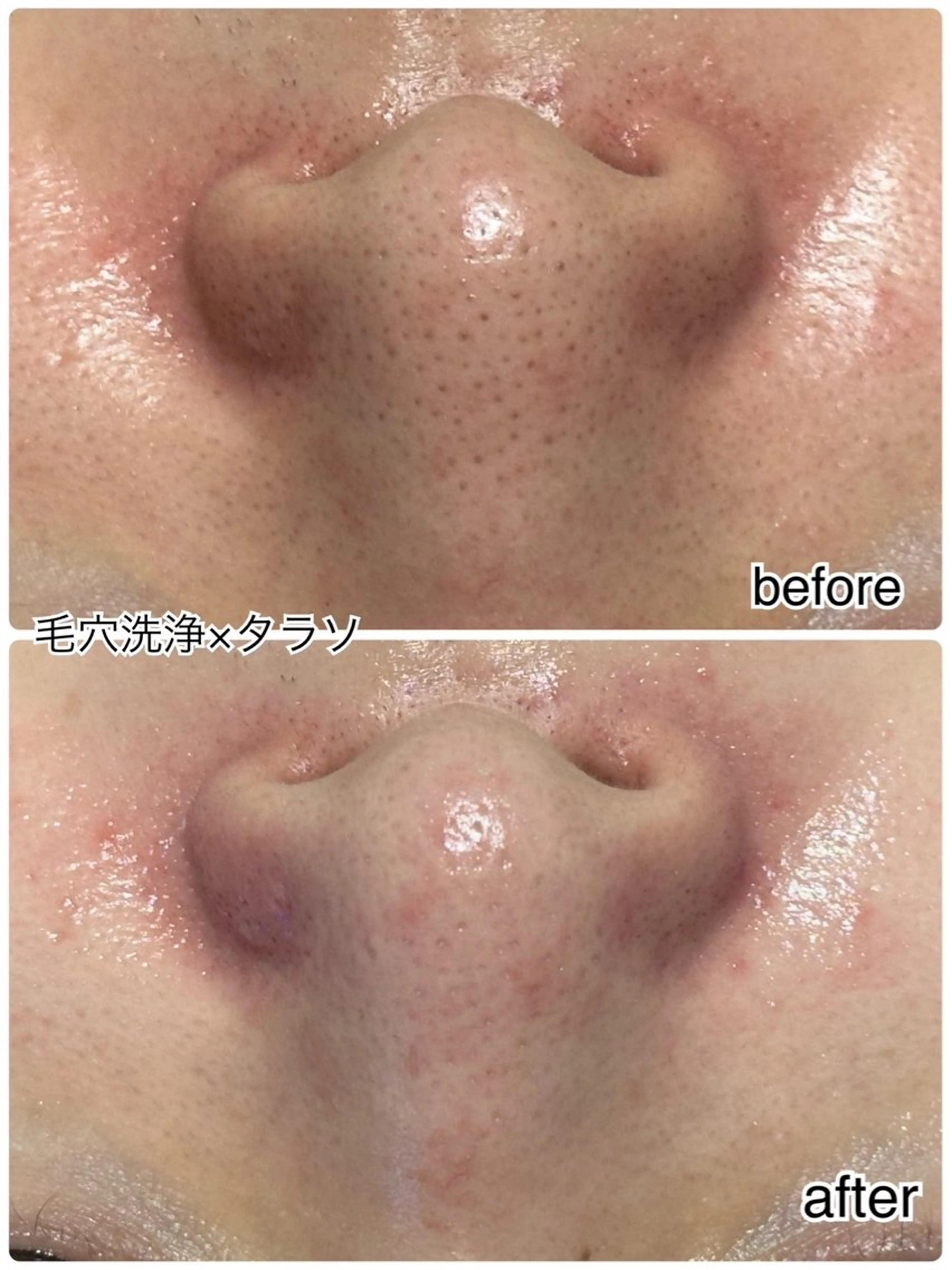 ENCHANT Kaede/肌質改善のその他イメージ