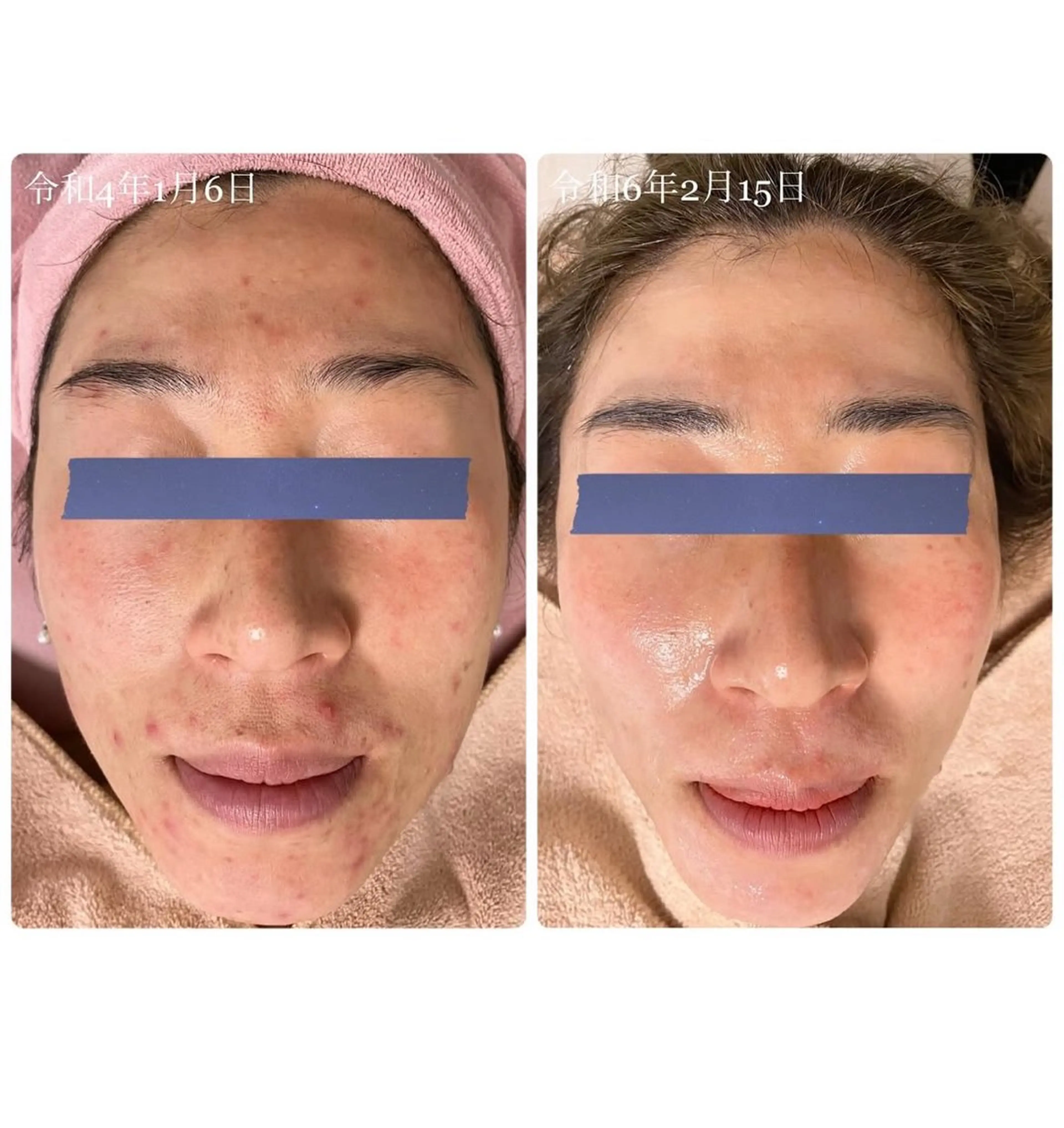 La Colzaのネイルデザイン