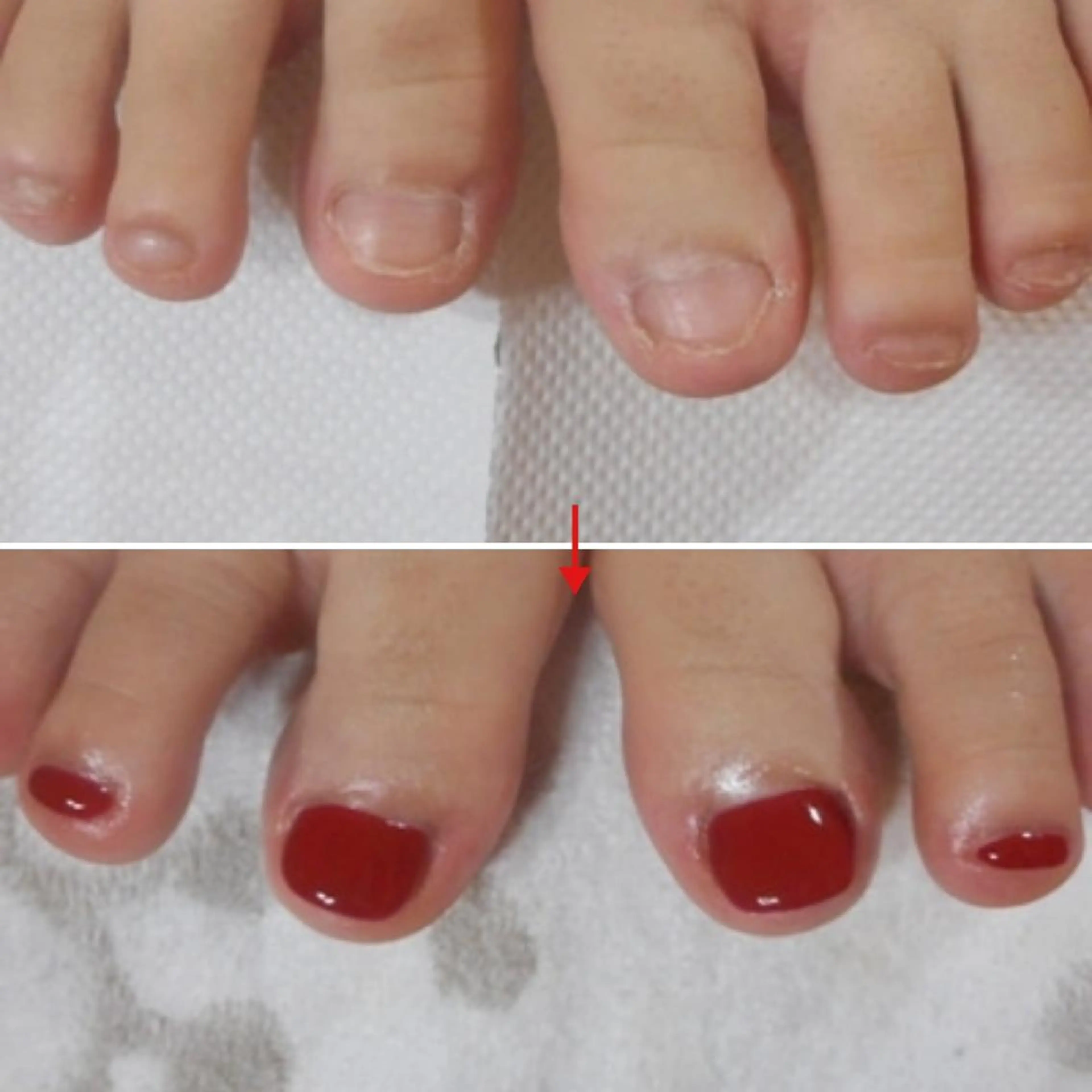 ネイル フットネイル ネイルサロンアリューム所属・ネイルサロン アリュームのネイルデザイン