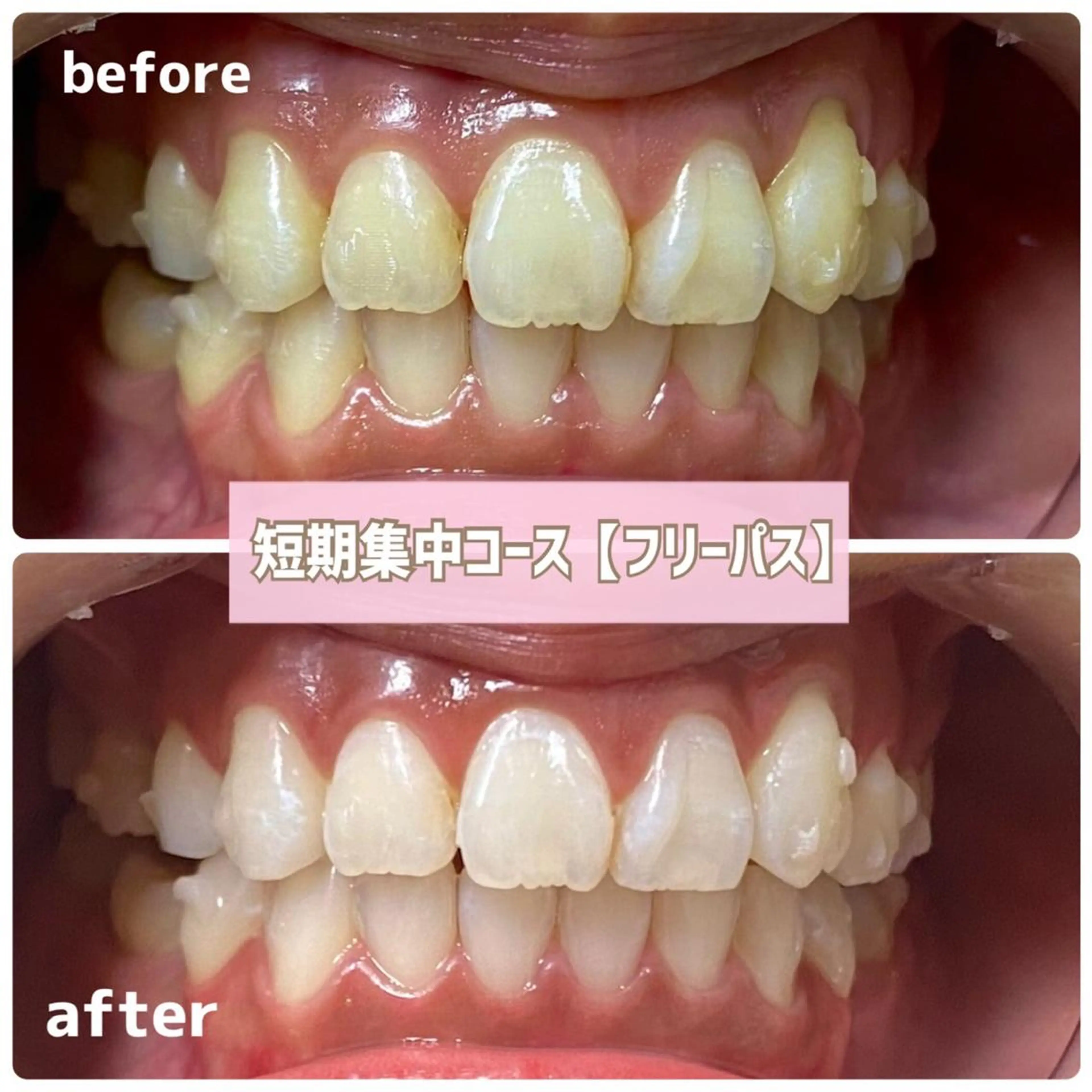 メンズ その他 ホワイトニングサロン BE WHITE金山のその他イメージ