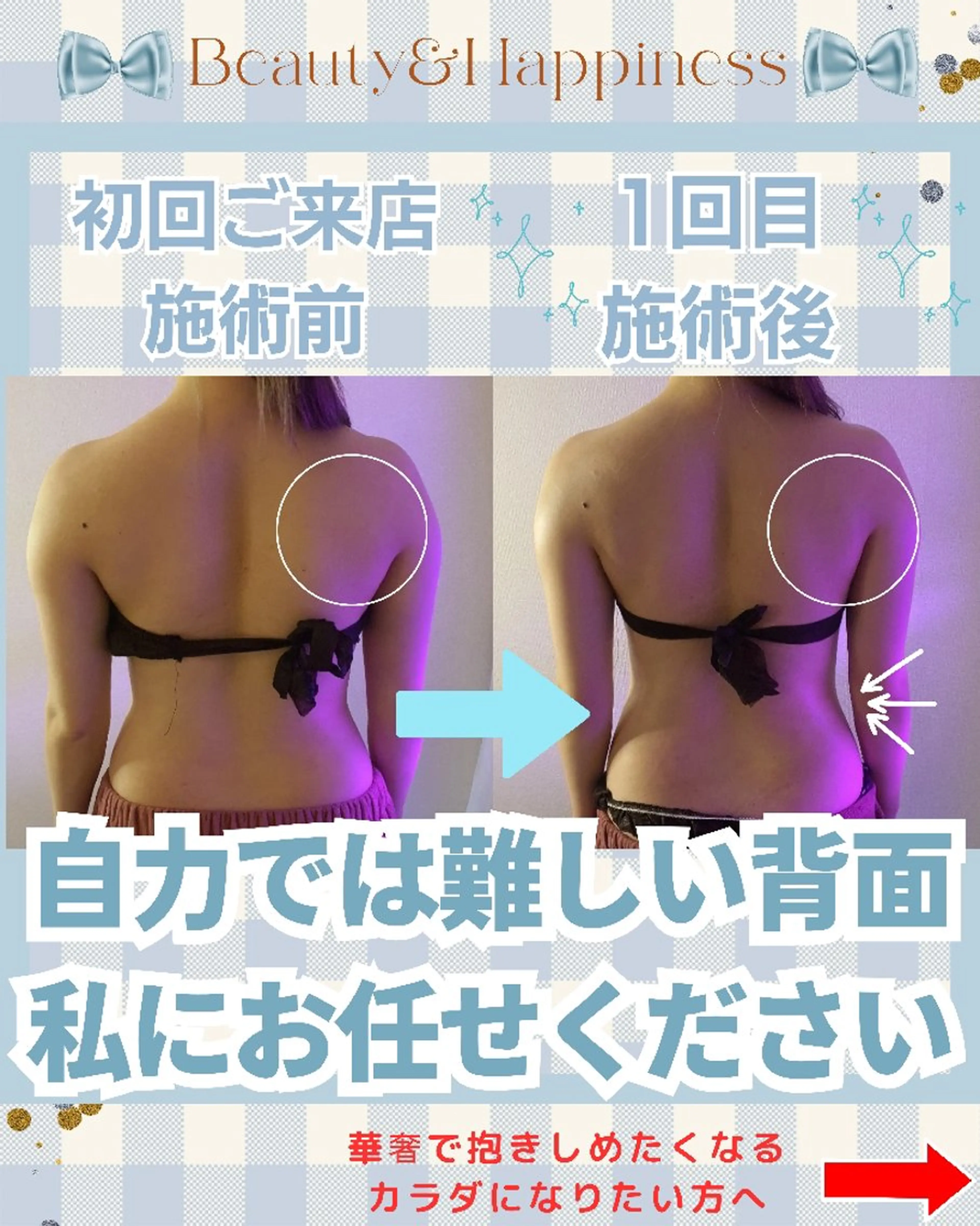 エステ リラク 痩身ハーブピーリング 筋膜リリース☆B&Hのエステ・リラクイメージ