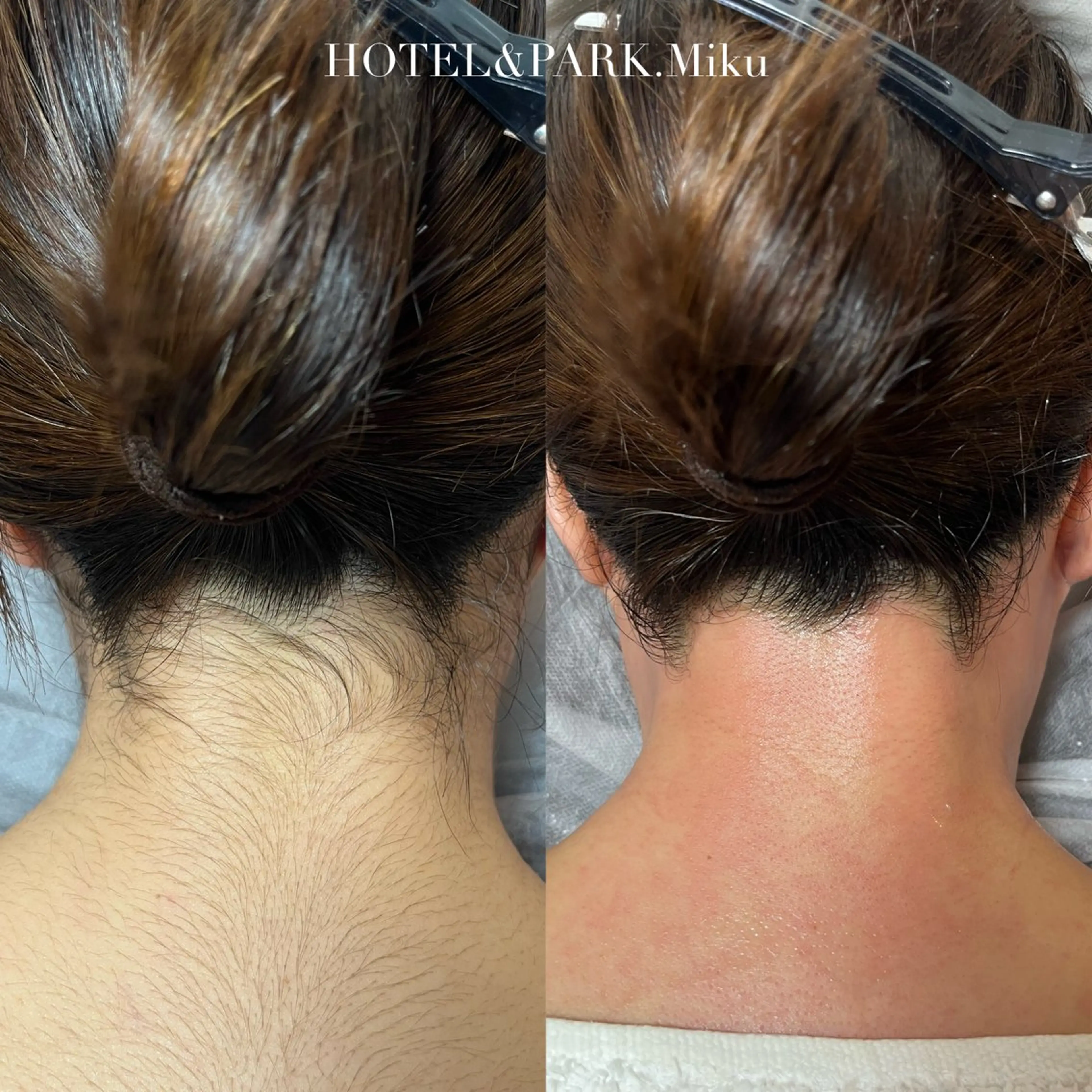 脱毛 HOTEL&PARK Mikuワックス脱毛のエステ・リラクイメージ