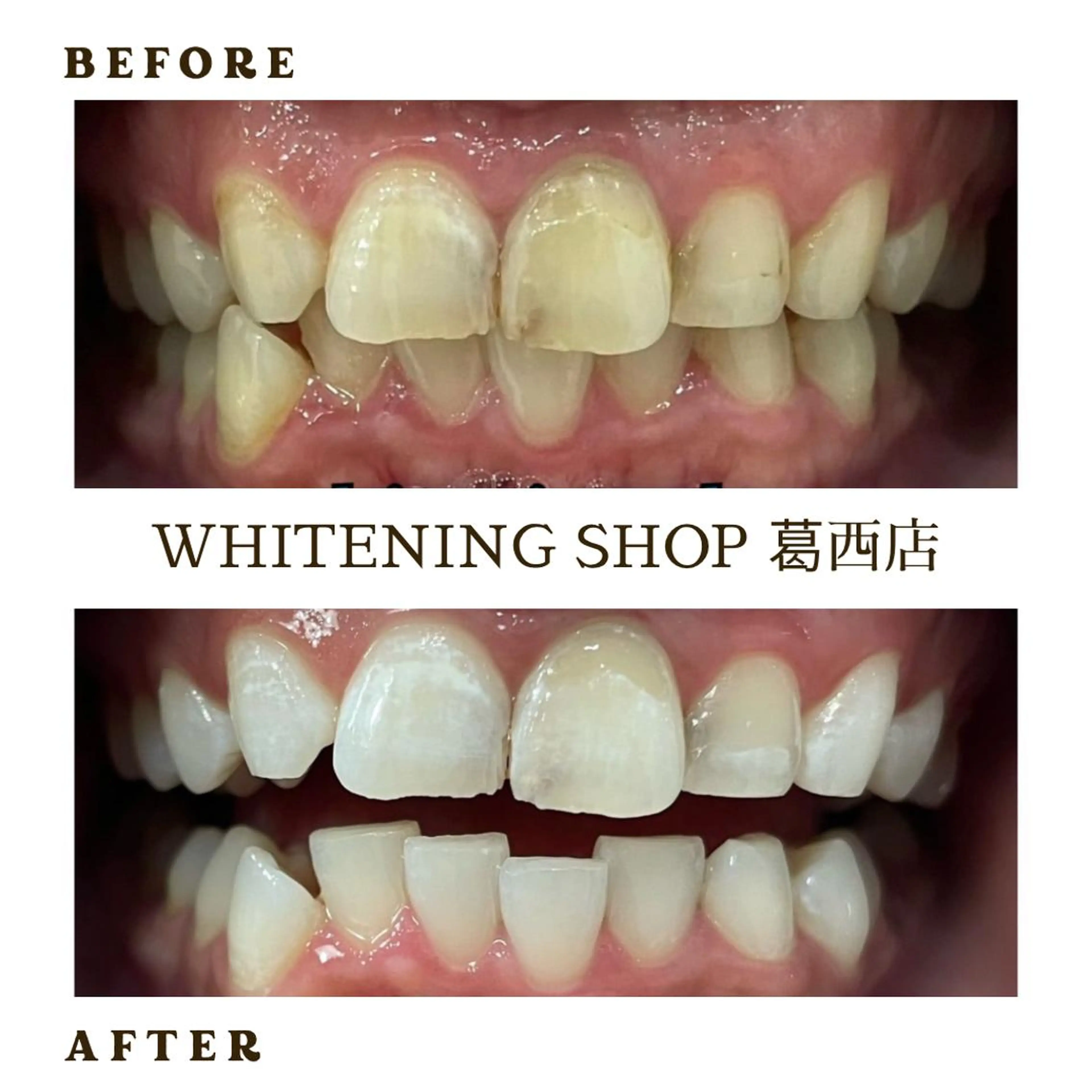 メンズ その他 ホワイトニング ショップ葛西店のその他イメージ