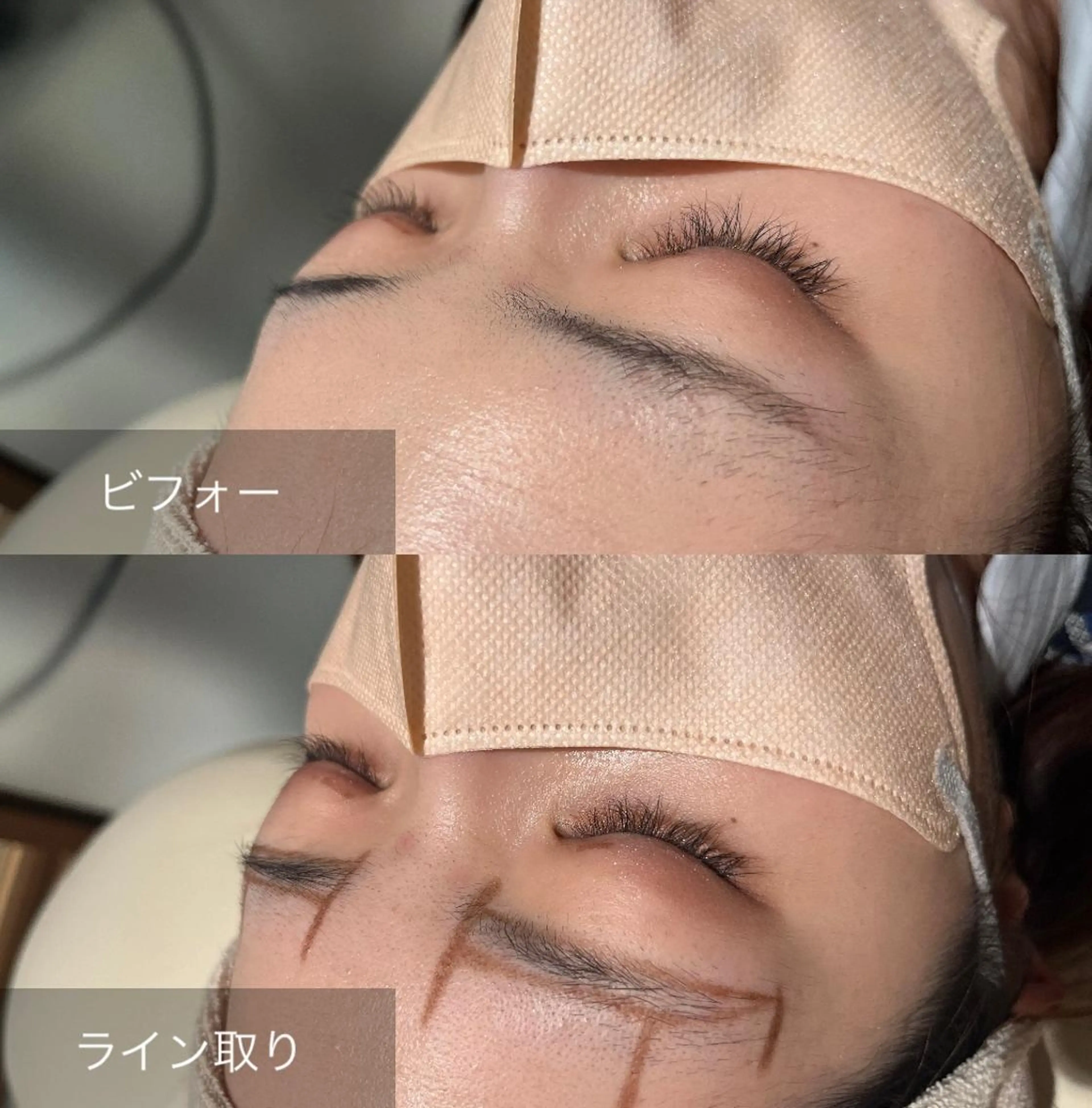 アイブロウ 眉毛ワックス脱毛 for woman所属・森 美優のエステ・リラクイメージ