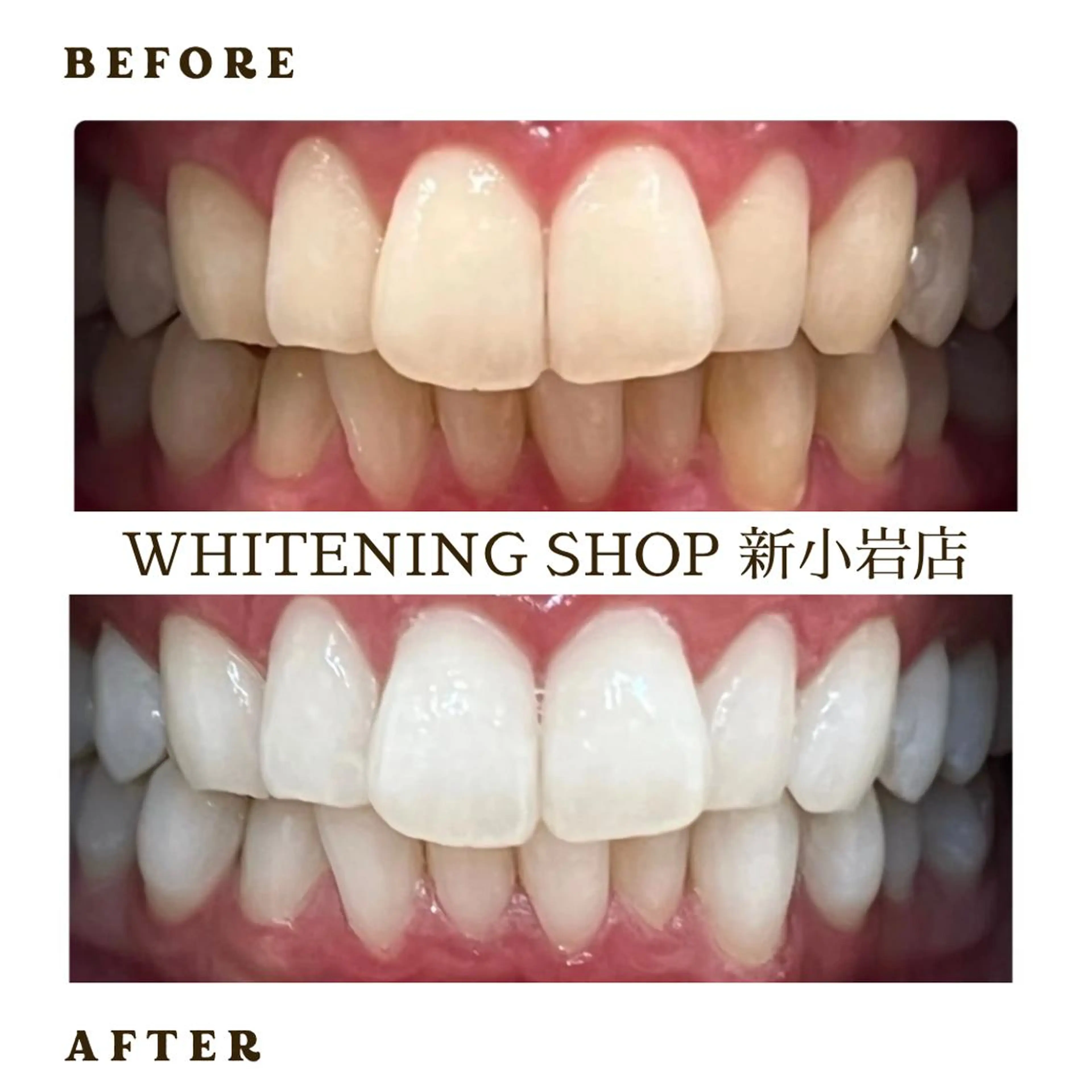 メンズ その他 ホワイトニング ショップ新小岩店のその他イメージ