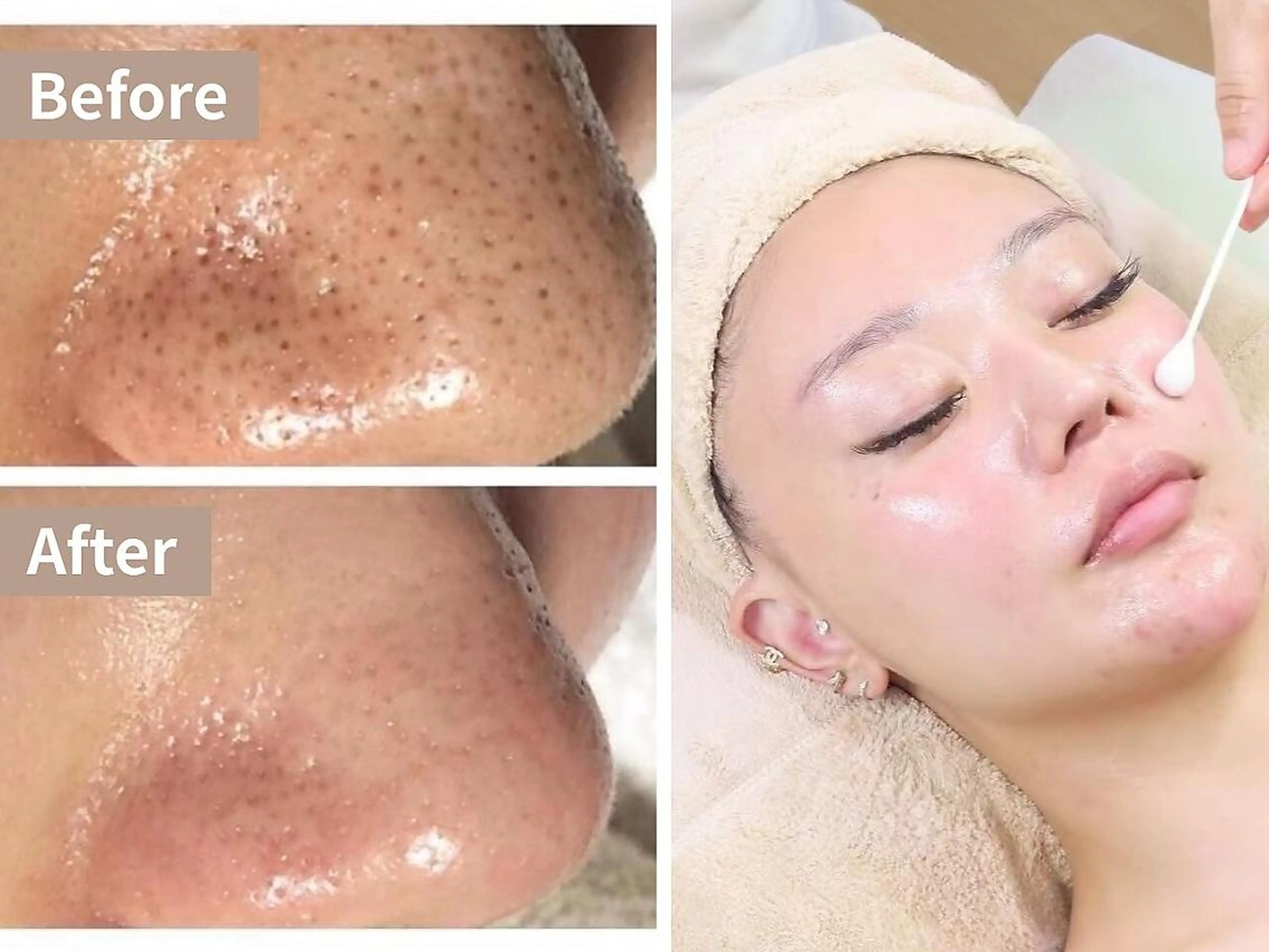 小顔コルギ・美肌 グラシーズのエステ・リラクイメージ