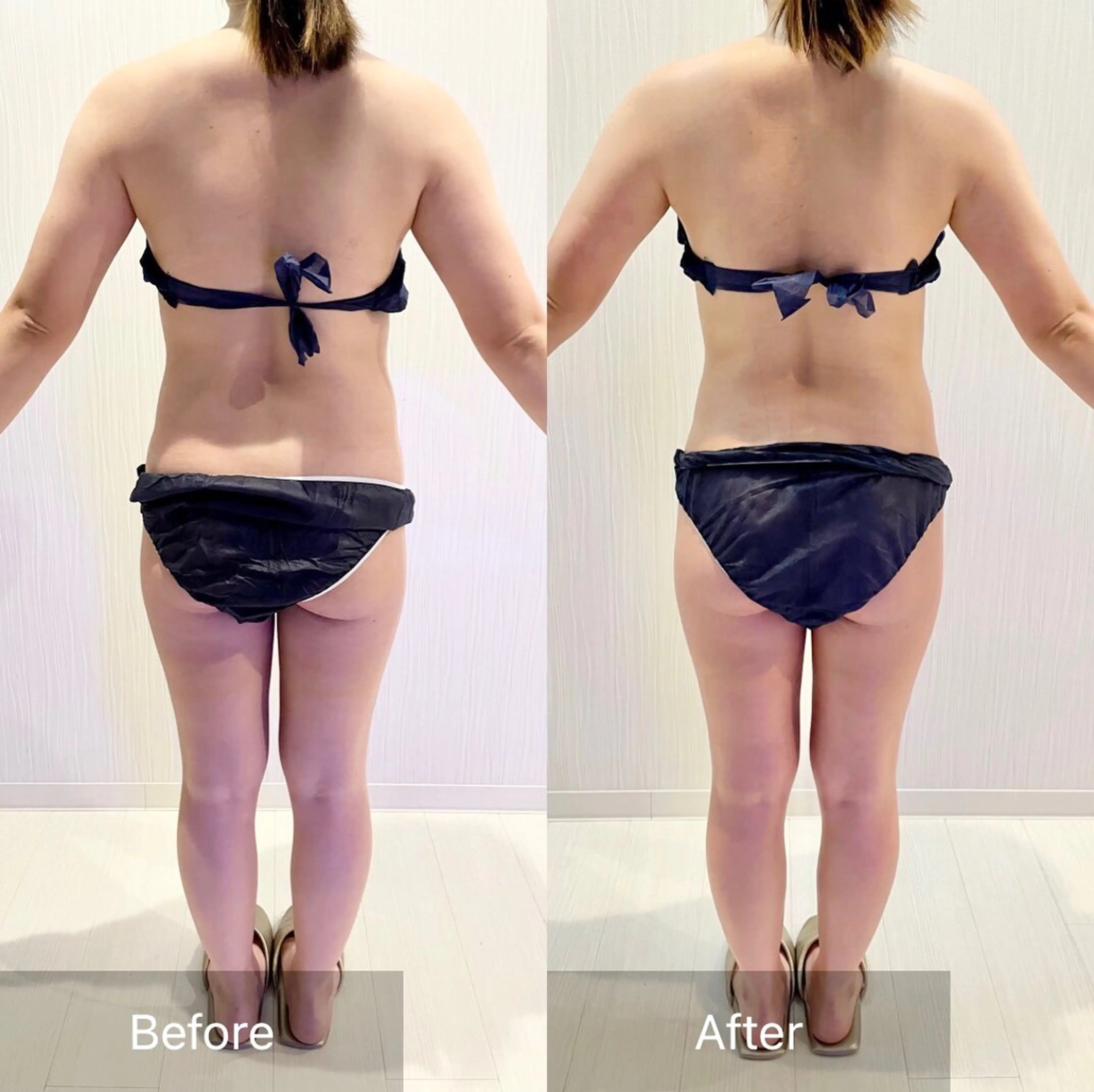 Nature（ナチュレ）所属・【脳洗浄/痩身】 nature東金のエステ・リラクイメージ