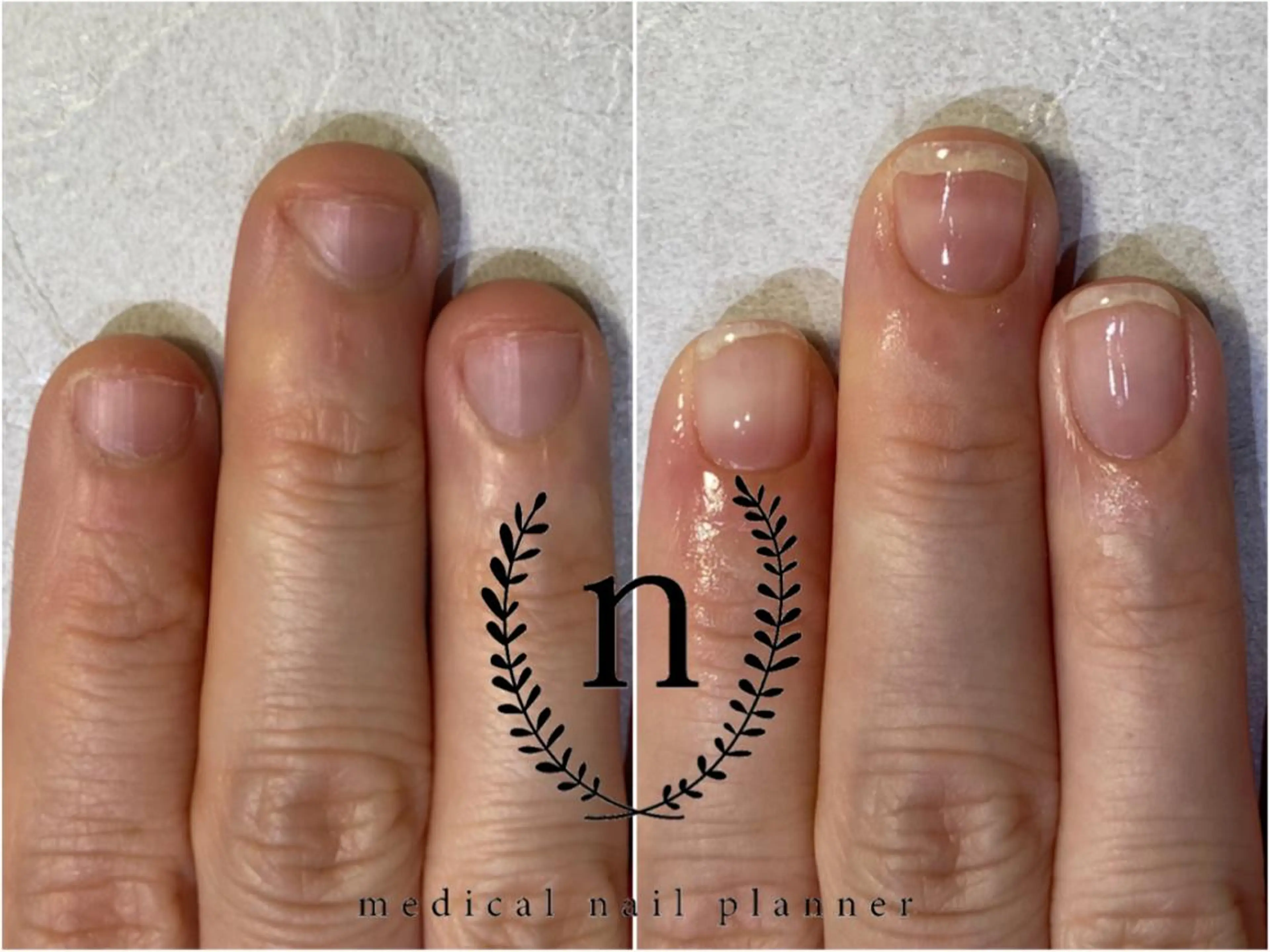 ネイル Rio 𓍼のネイルデザイン