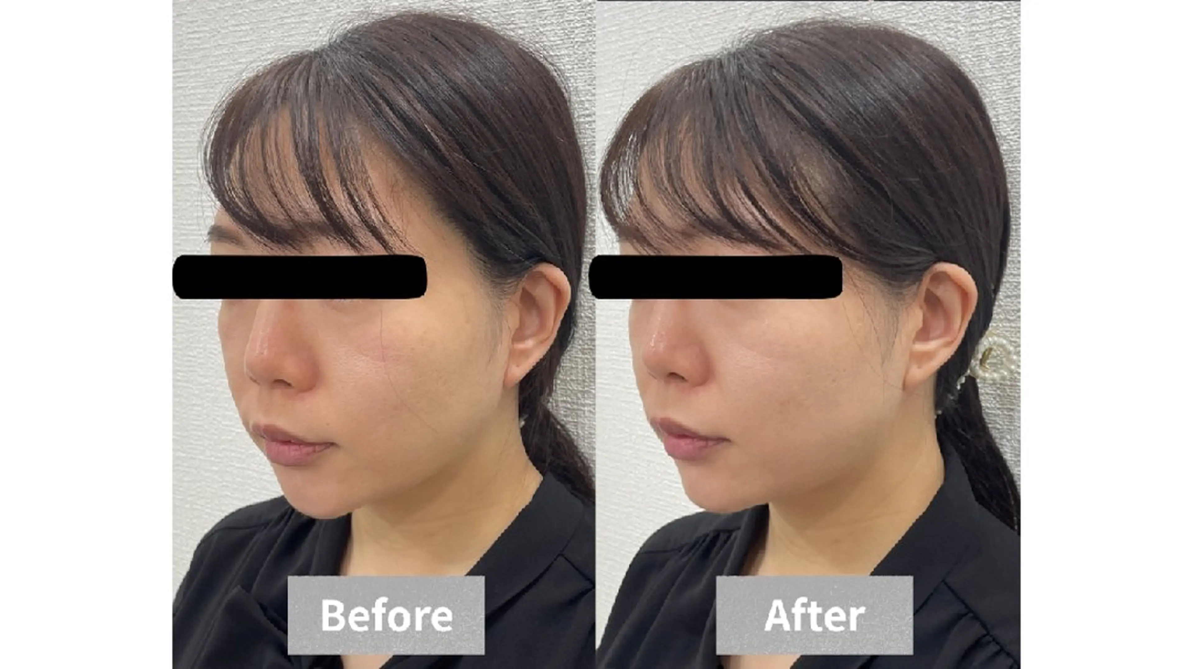 エステ 【小顔・毛穴ケア】 セラピスト　和田紋子のエステ・リラクイメージ