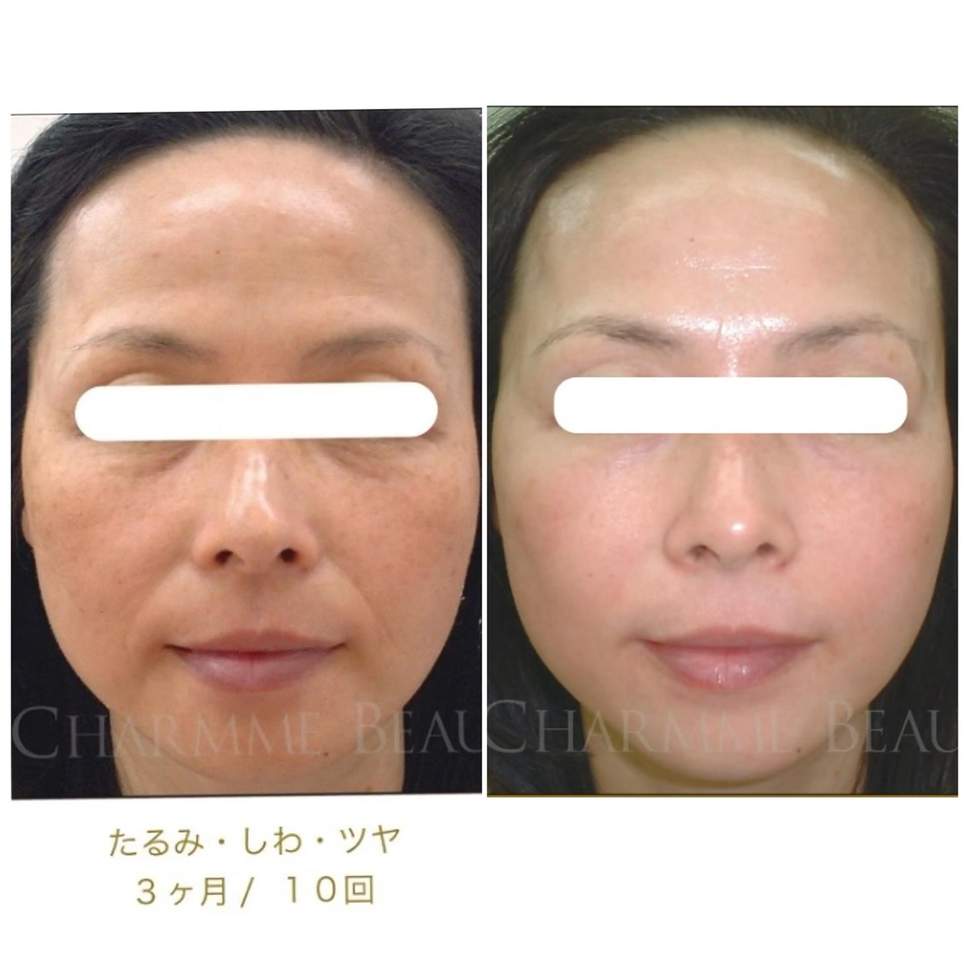 その他 シミケア専門サロン 10POINT.Kのエステ・リラクイメージ