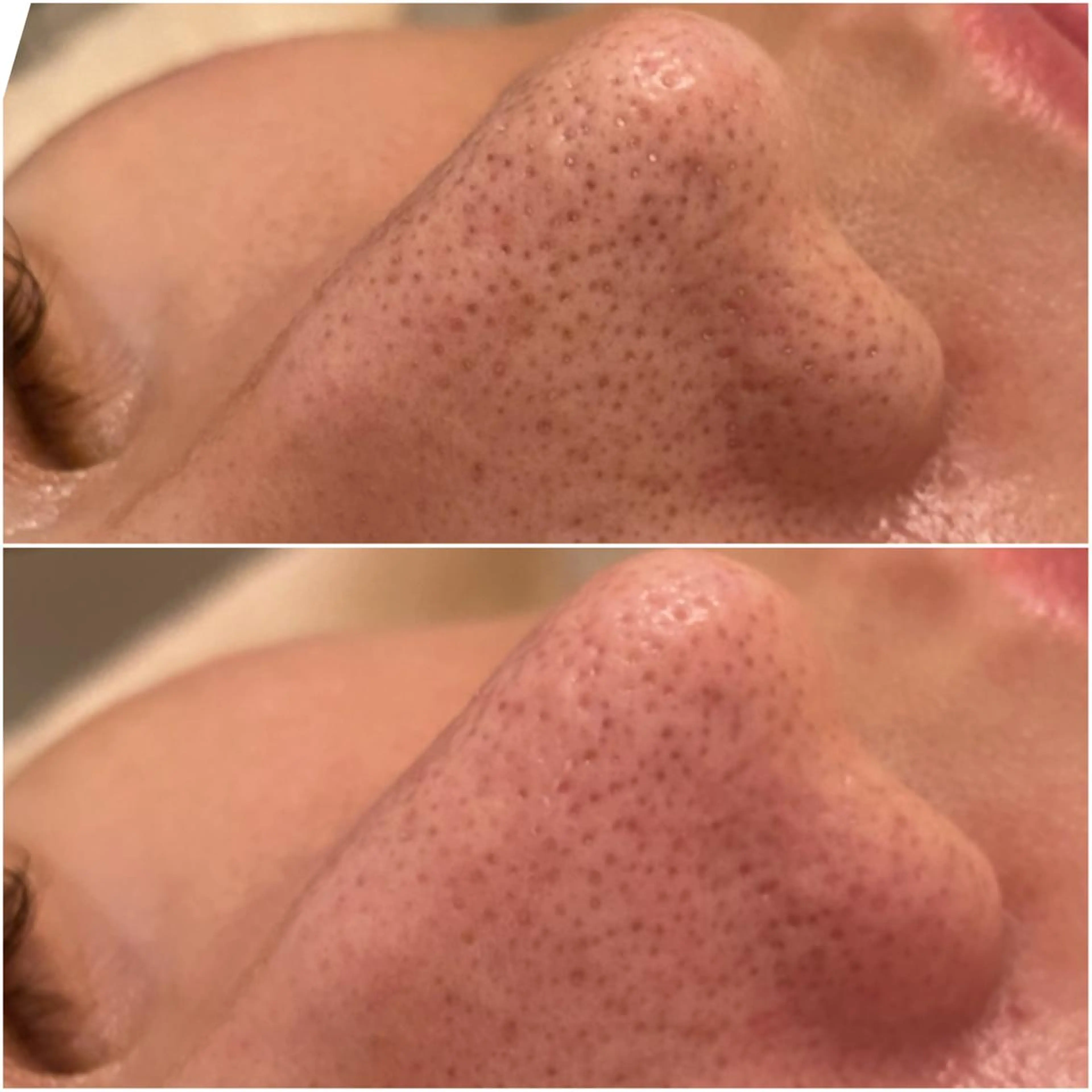 ✨美肌水光✨ アトリエリュバンのエステ・リラクイメージ