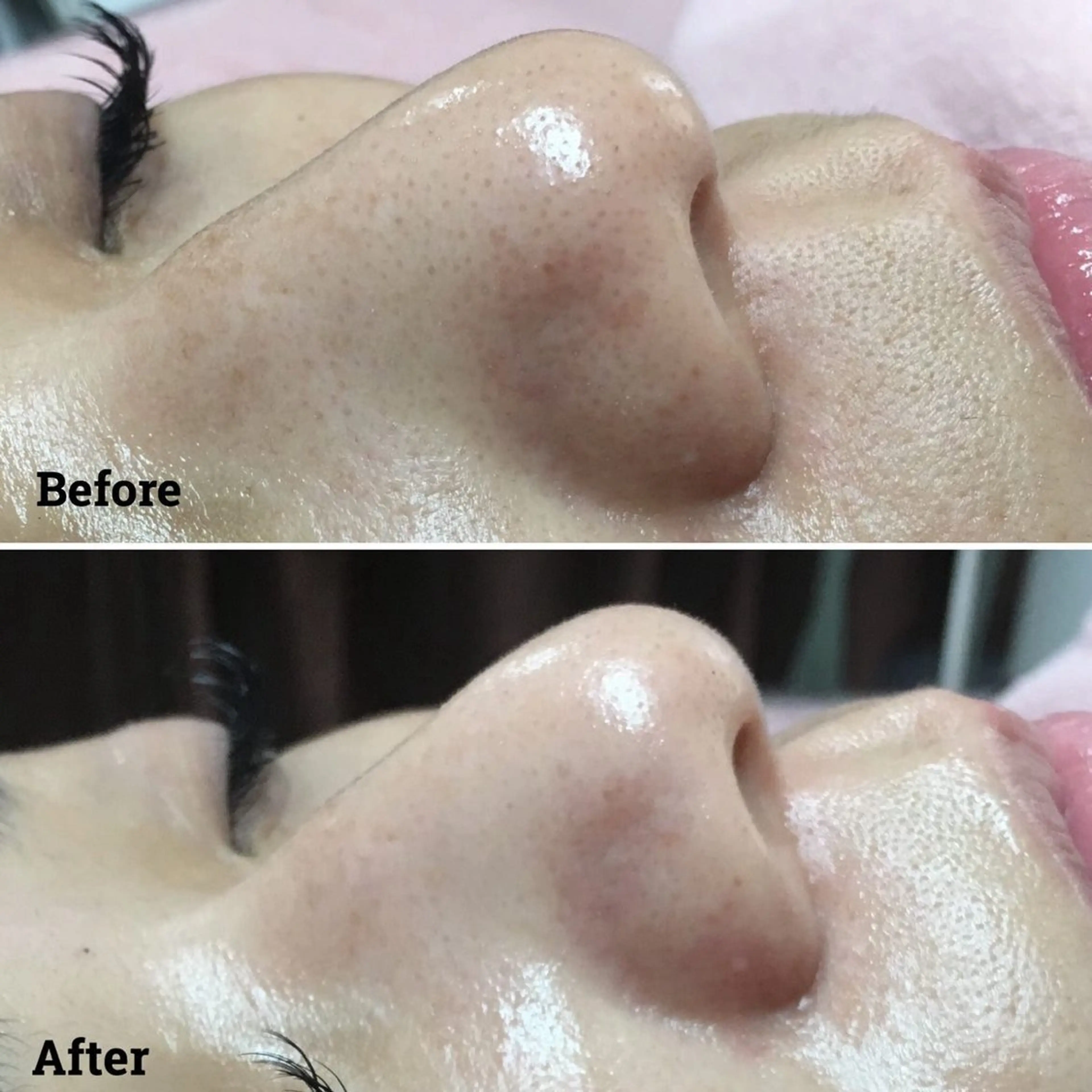 aroma  YURARI所属・韓国艶美人// 毛穴ケア🌹のエステ・リラクイメージ