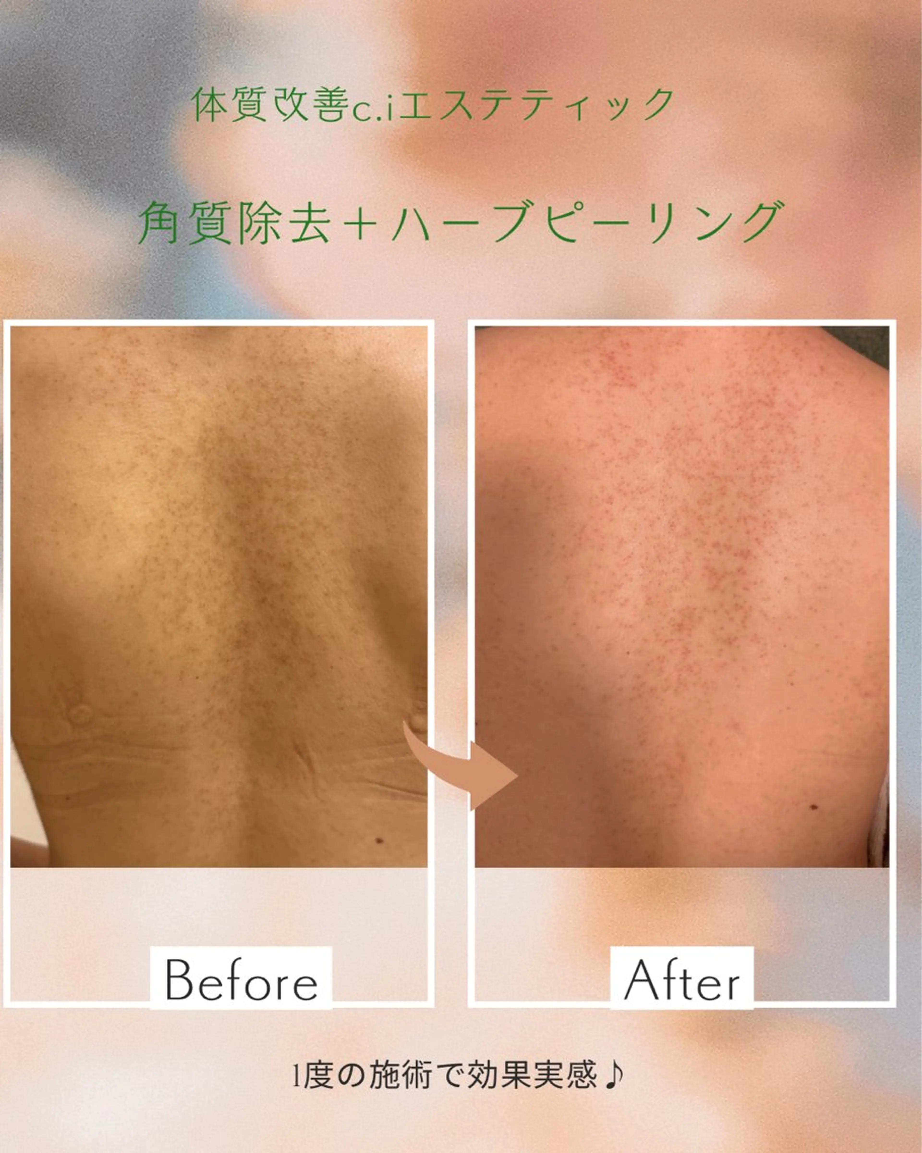 エステ よもぎ蒸しサロンc.iエステティック所属・睡眠の質／体質改善 c.iエステティックのエステ・リラクイメージ