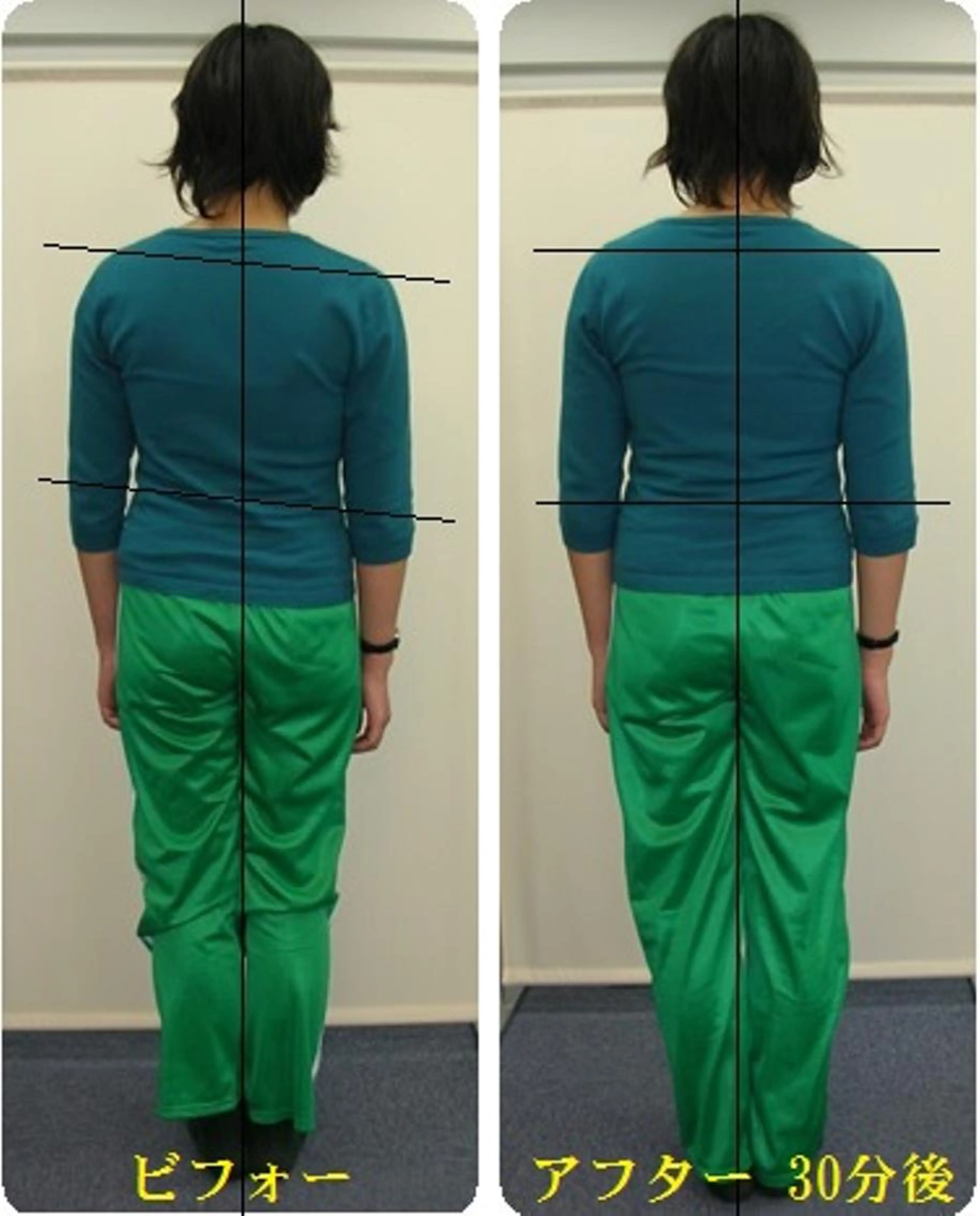 【整体★猫背】猫背,巻き肩,反り腰,集中整体で美しい姿勢へ◆人気体験￥4,980現金限定の写真