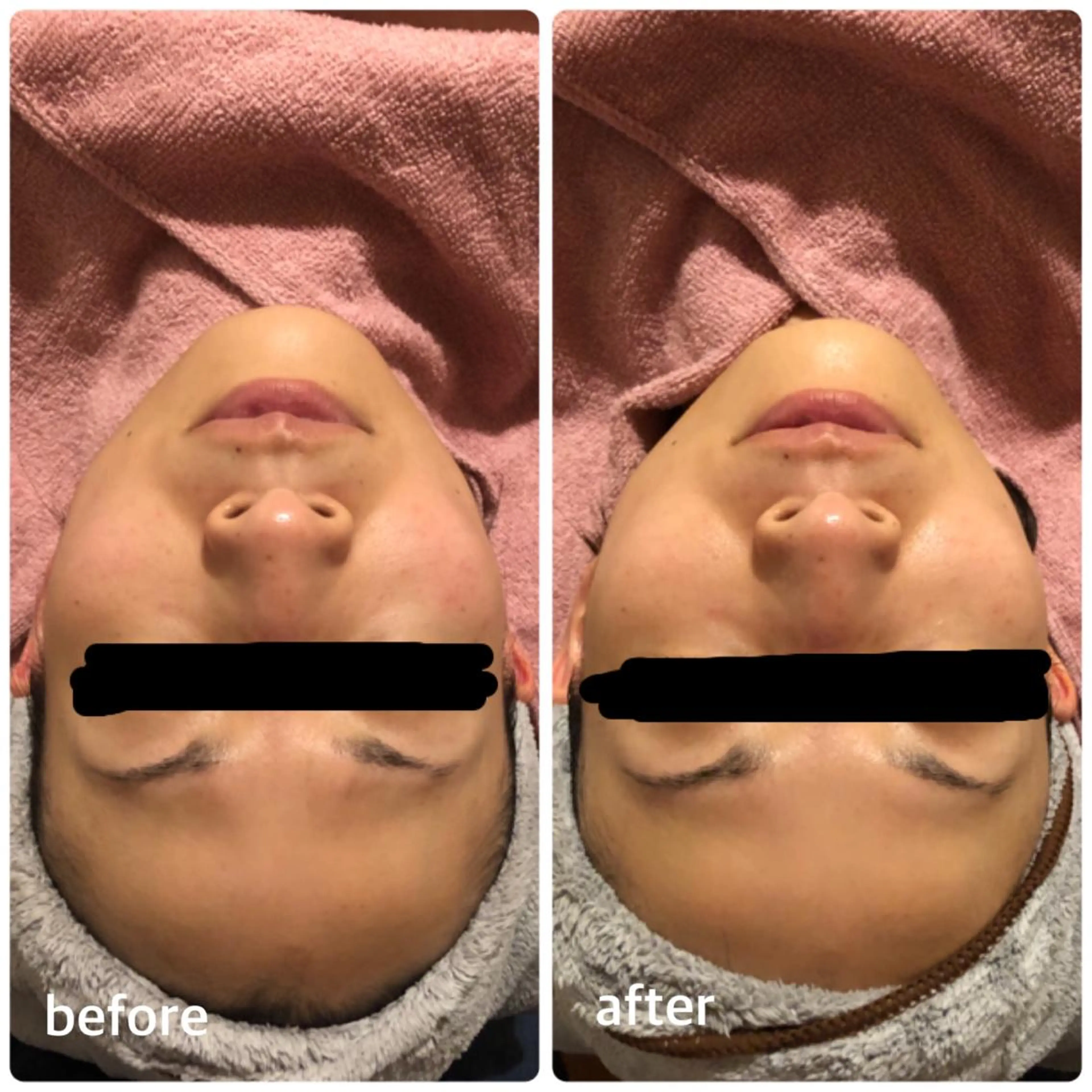 未病ケアサロン　EMINY所属・未病ケアサロン EMINY☺︎勝俣のエステ・リラクイメージ