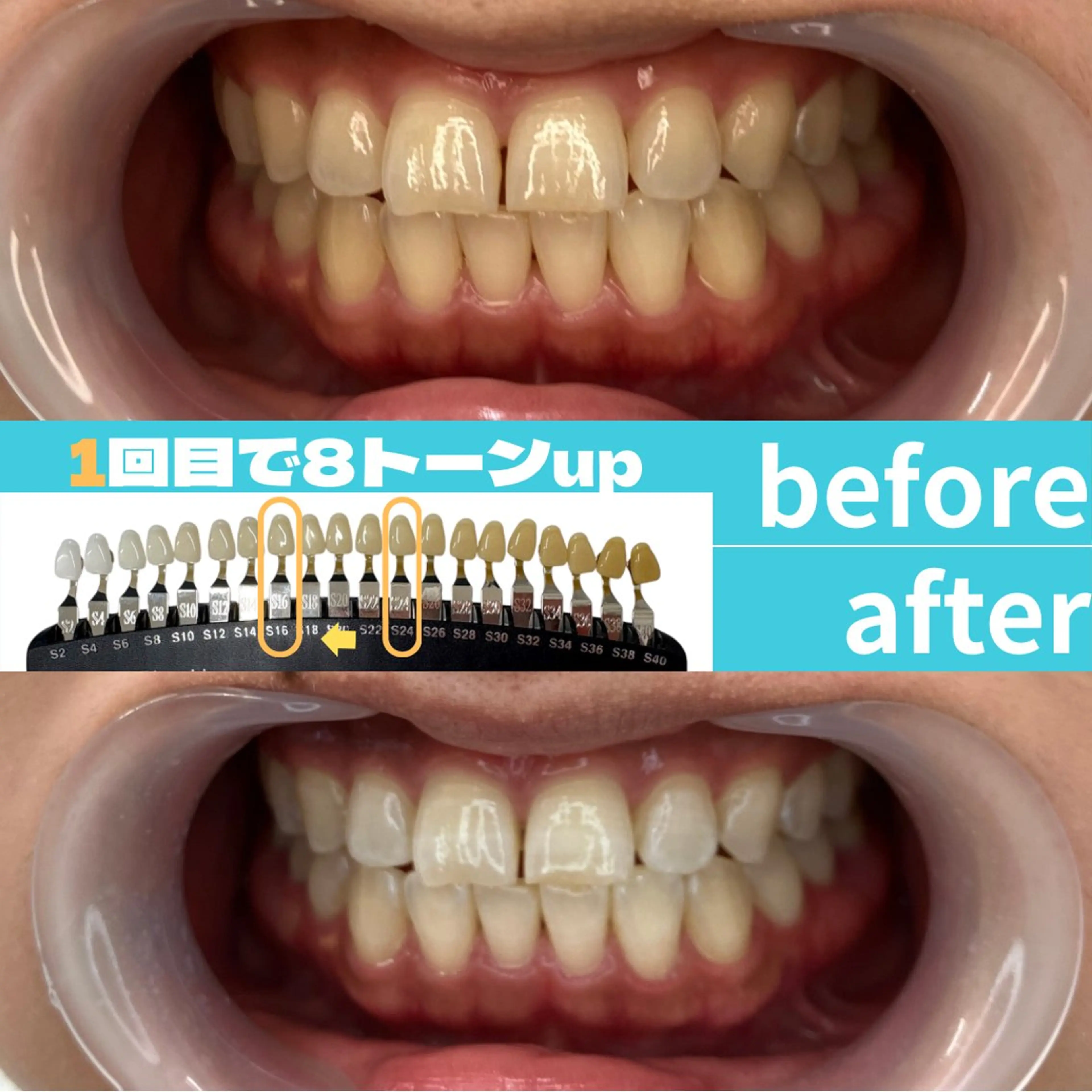 エステ s rikoのエステ・リラクイメージ