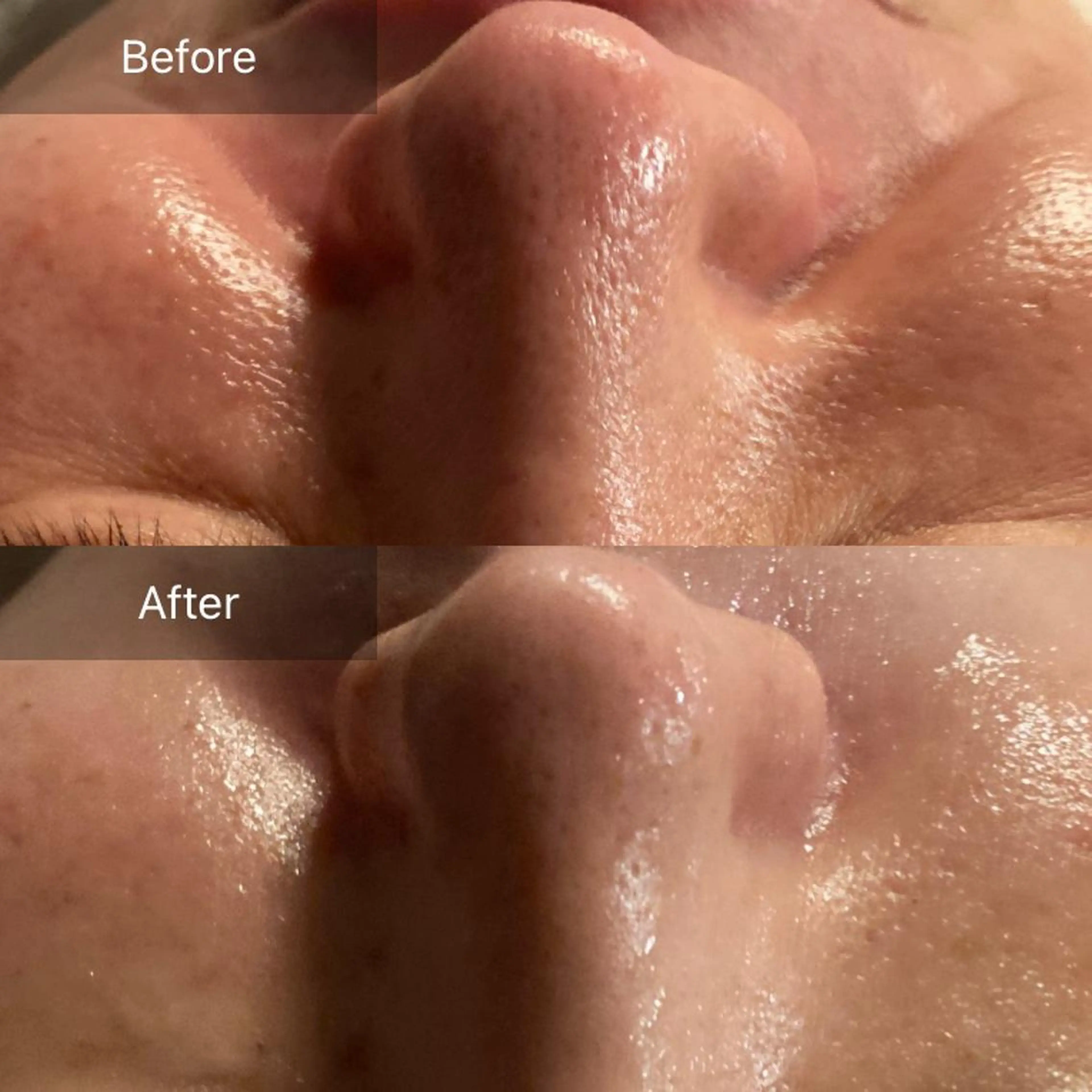 Mandarin Orange所属・毛穴から始める肌メン テマンダリンオレンジのエステ・リラクイメージ