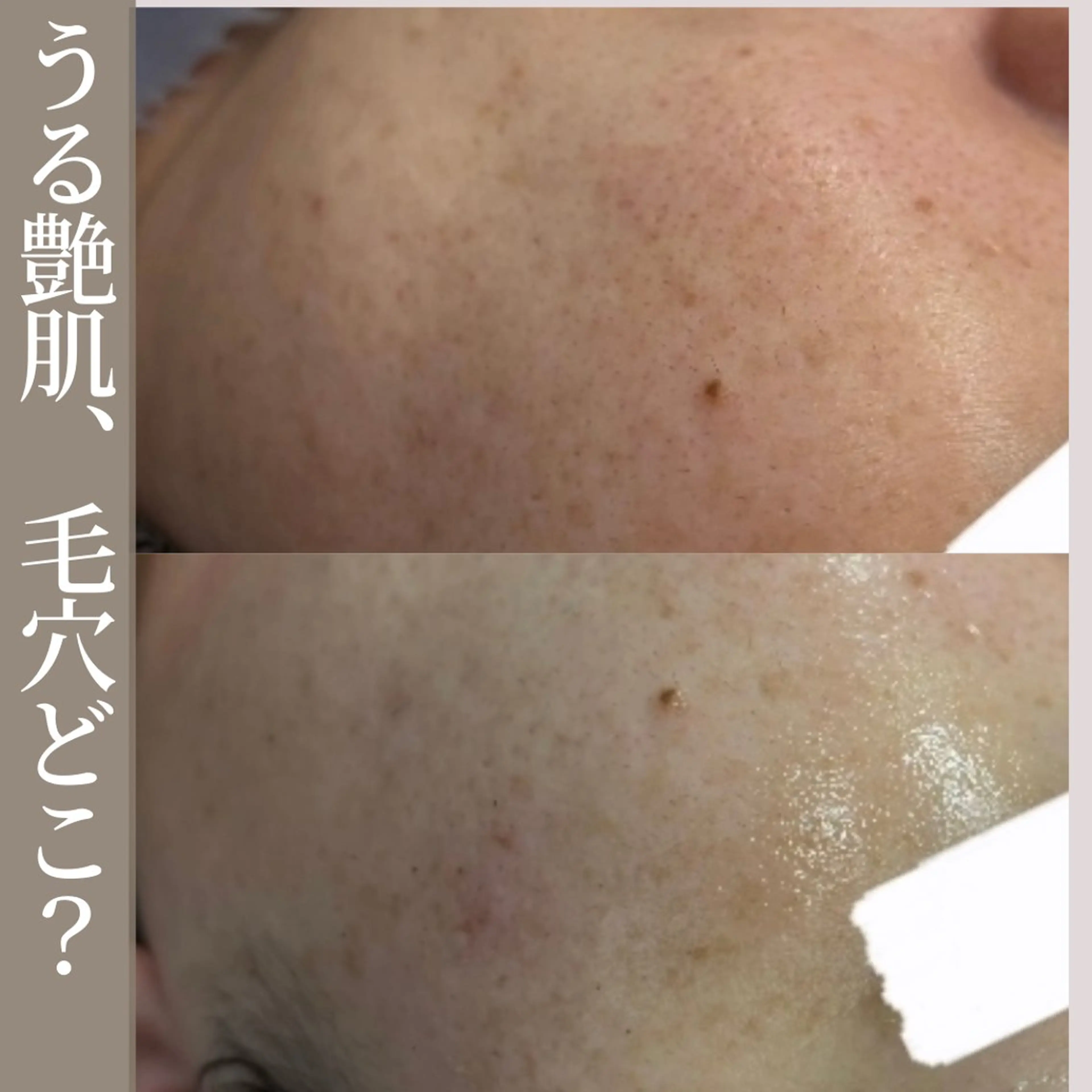 エステ ニキビ毛穴専門店Beautysalon Luana所属・小林 まいのエステ・リラクイメージ