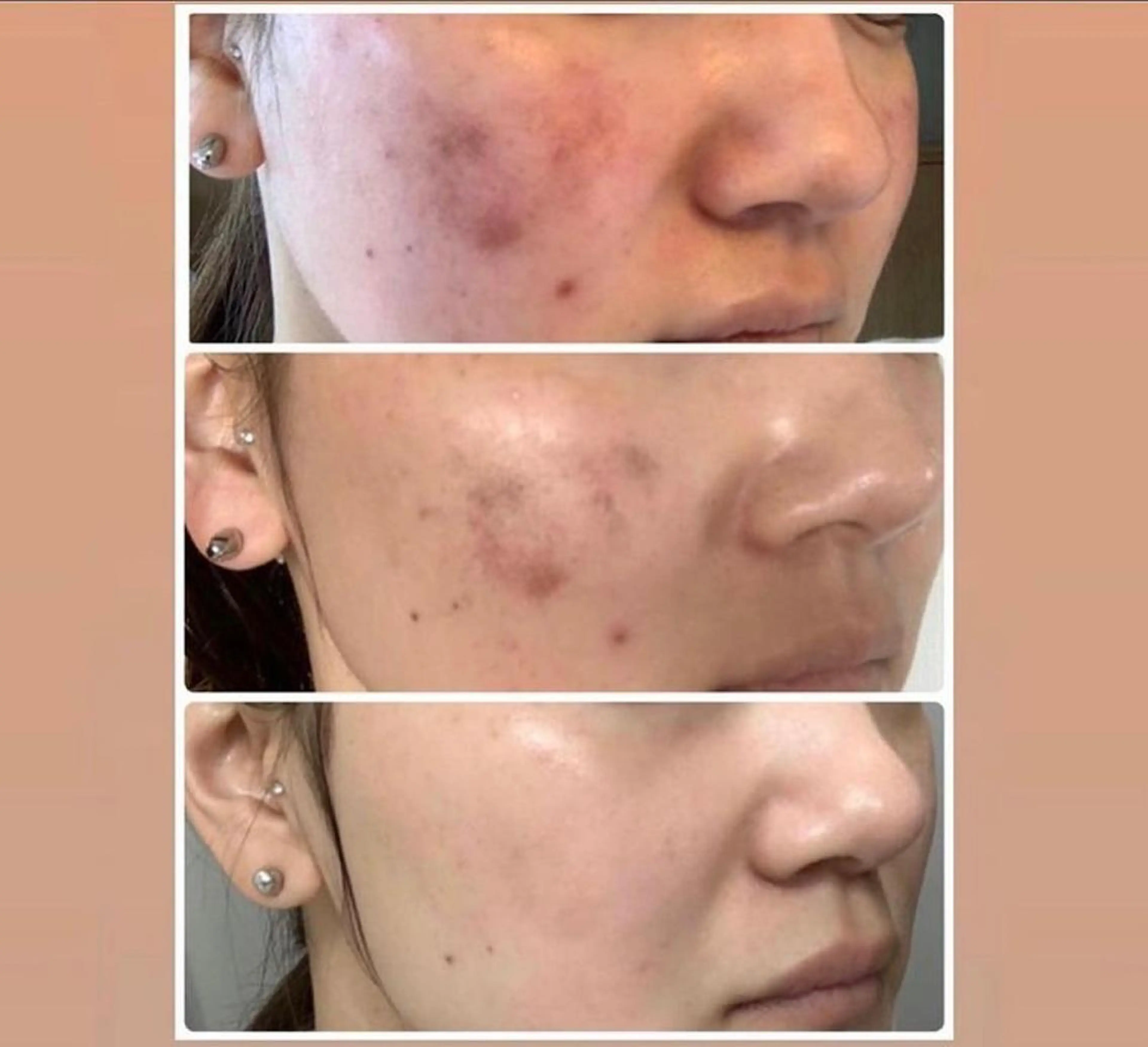 エステ 美顔秘密基地新宮所属・美顔秘密基地 新宮のその他イメージ