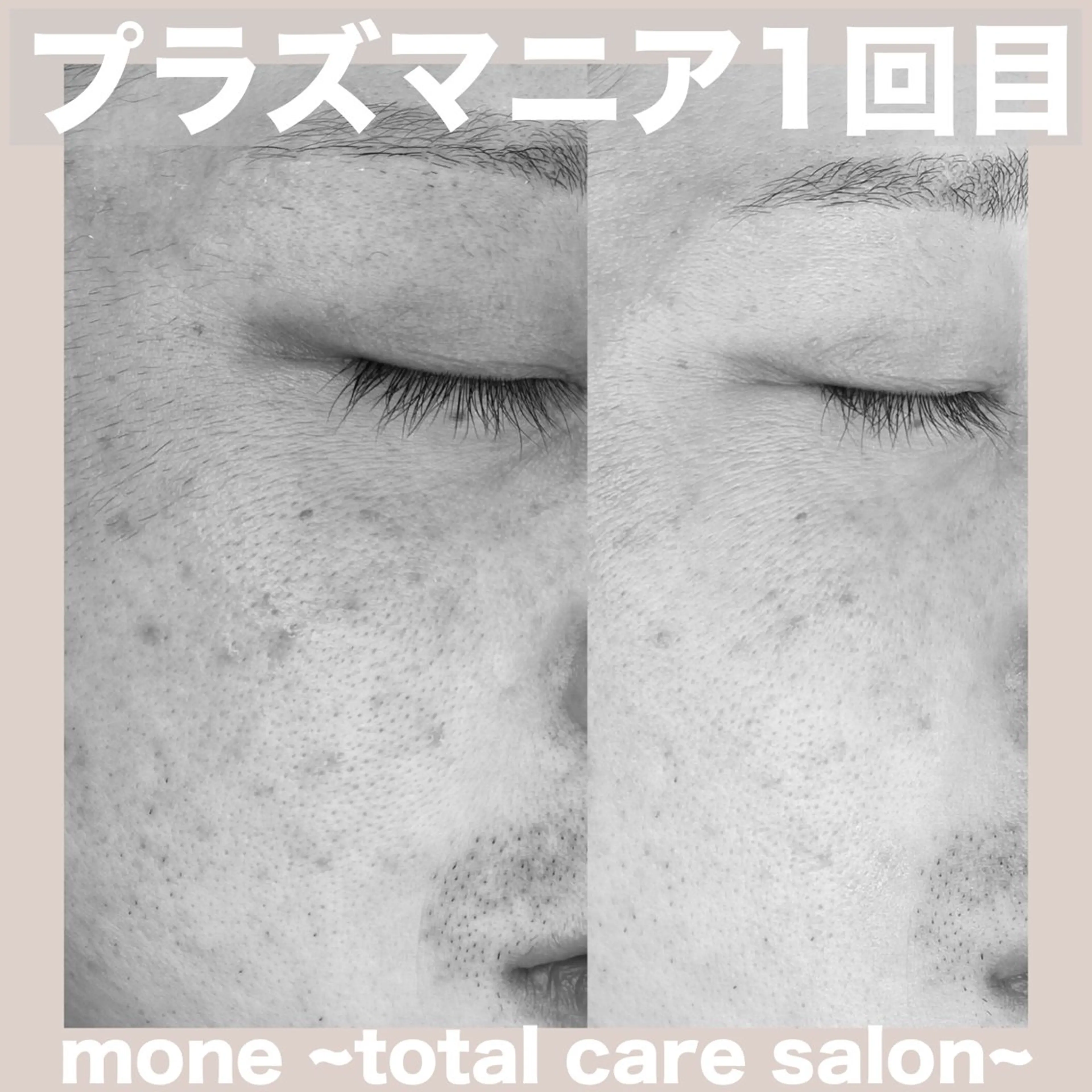 エステ mone~total care salon~所属・mone (モーネ)のマツエク・マツパデザイン