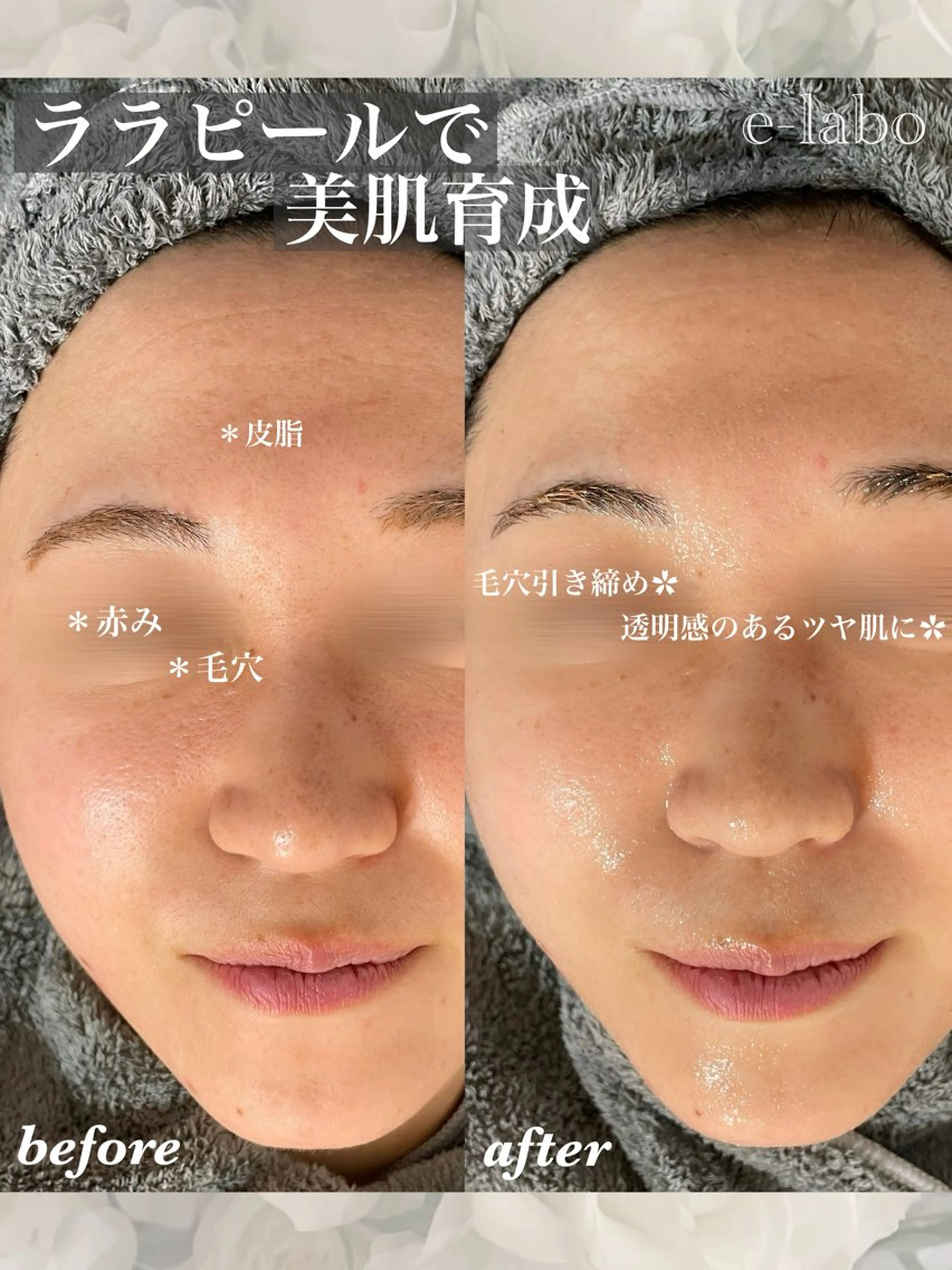 e-LABO こいずみのエステ・リラクイメージ