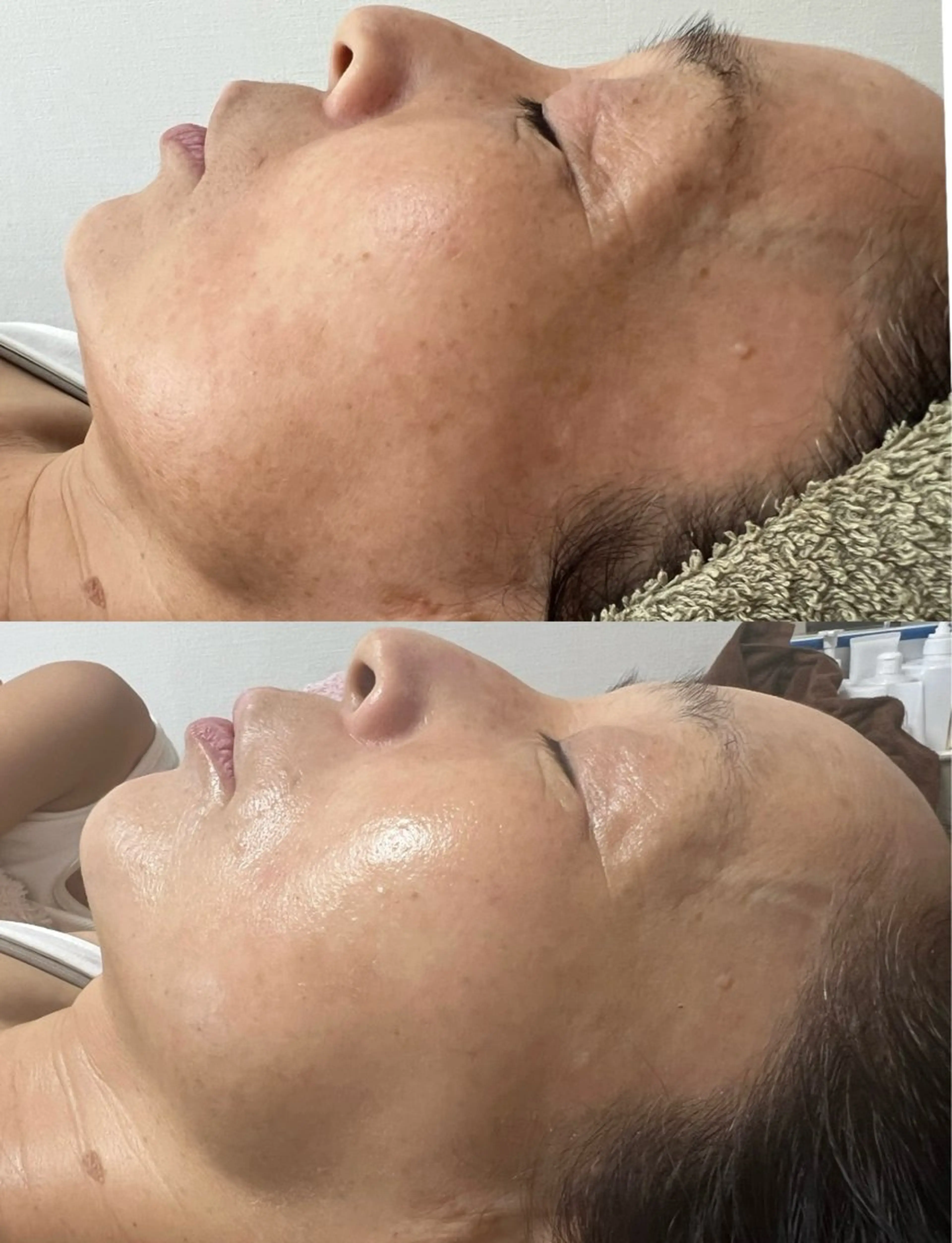 Beauty   Salon  Adiy所属・Adiy ikumiのエステ・リラクイメージ