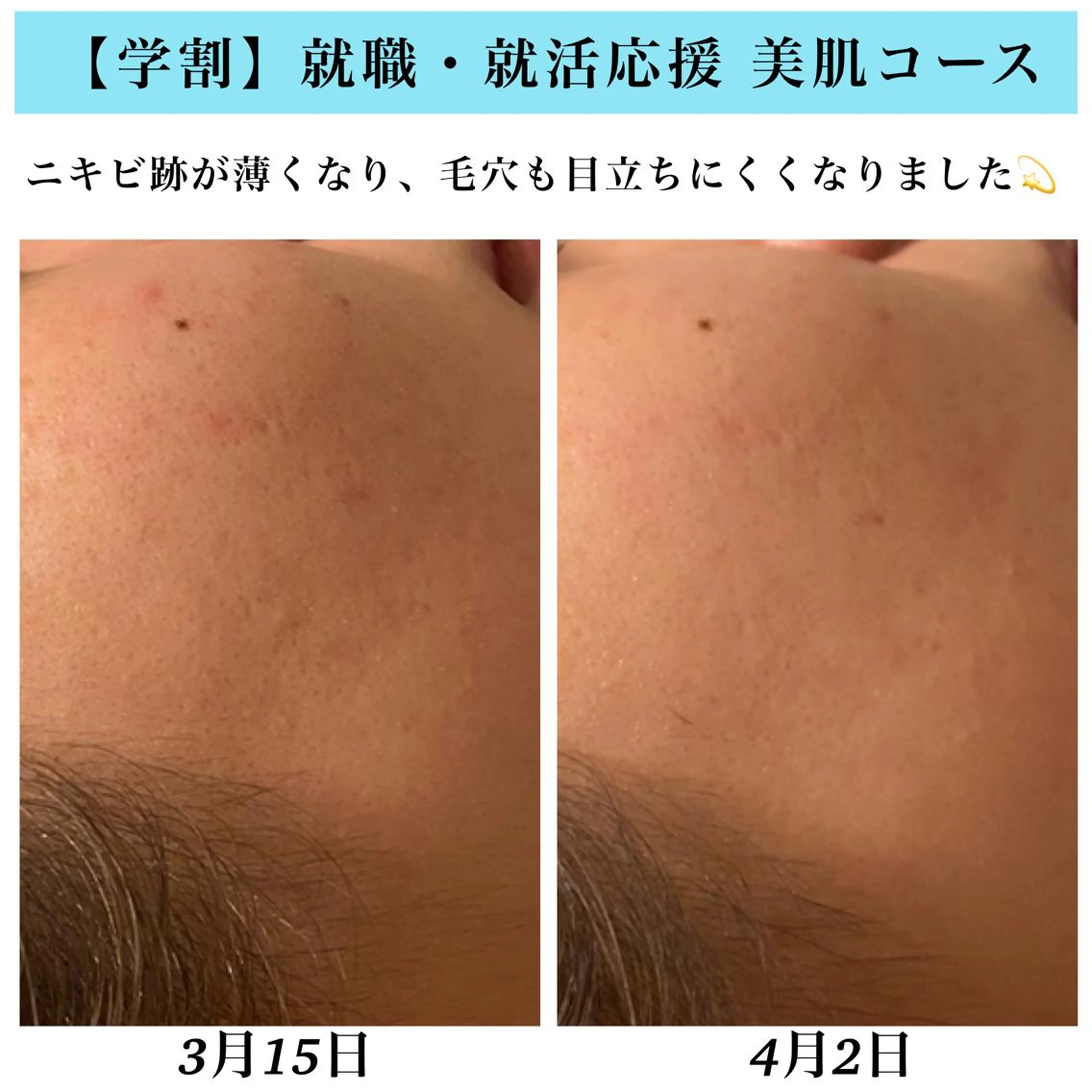 エステ Bellesthe （ベルエステ）のエステ・リラクイメージ