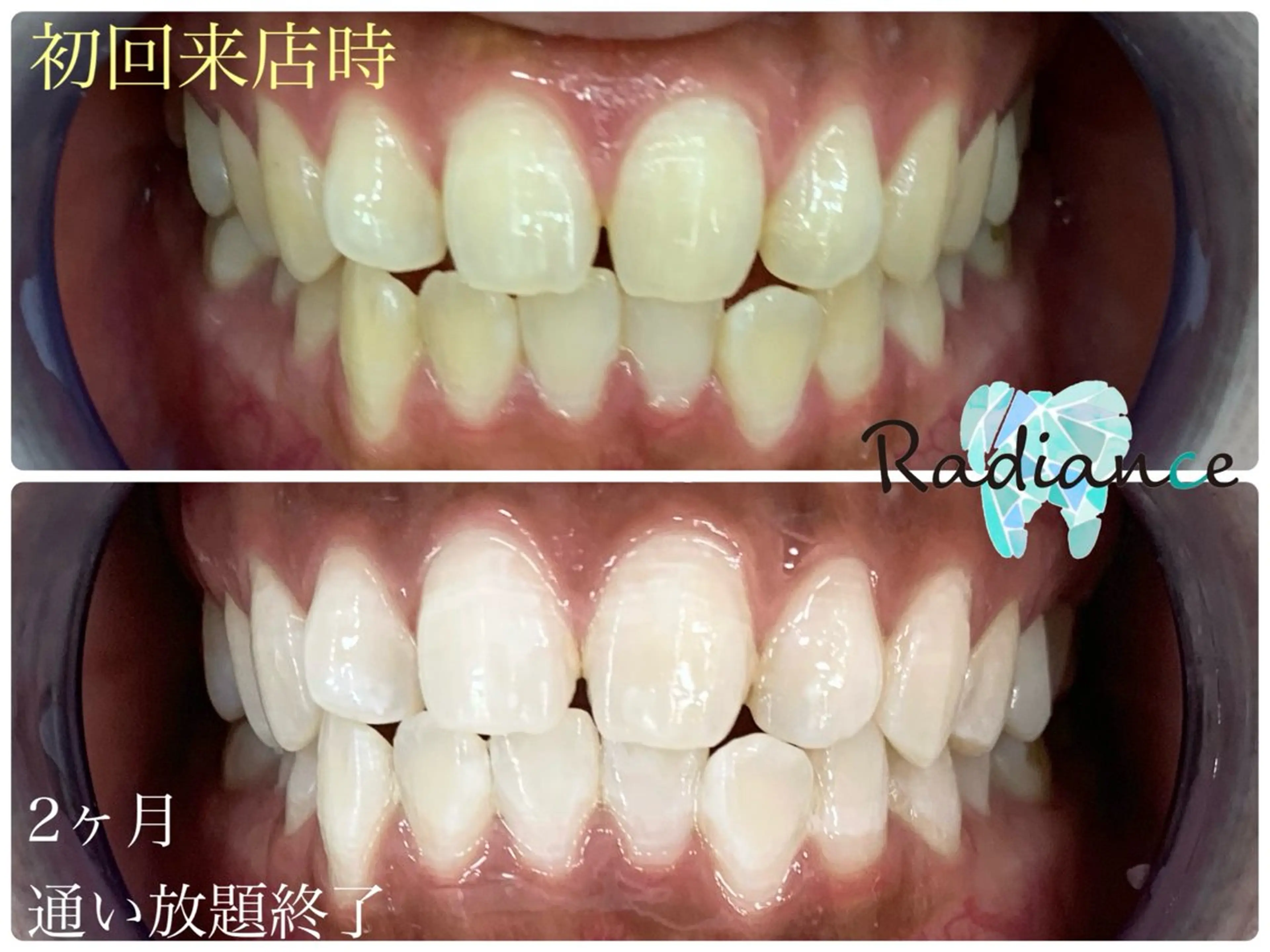 その他 札幌ホワイトニング ラディアンス札幌駅店のその他イメージ