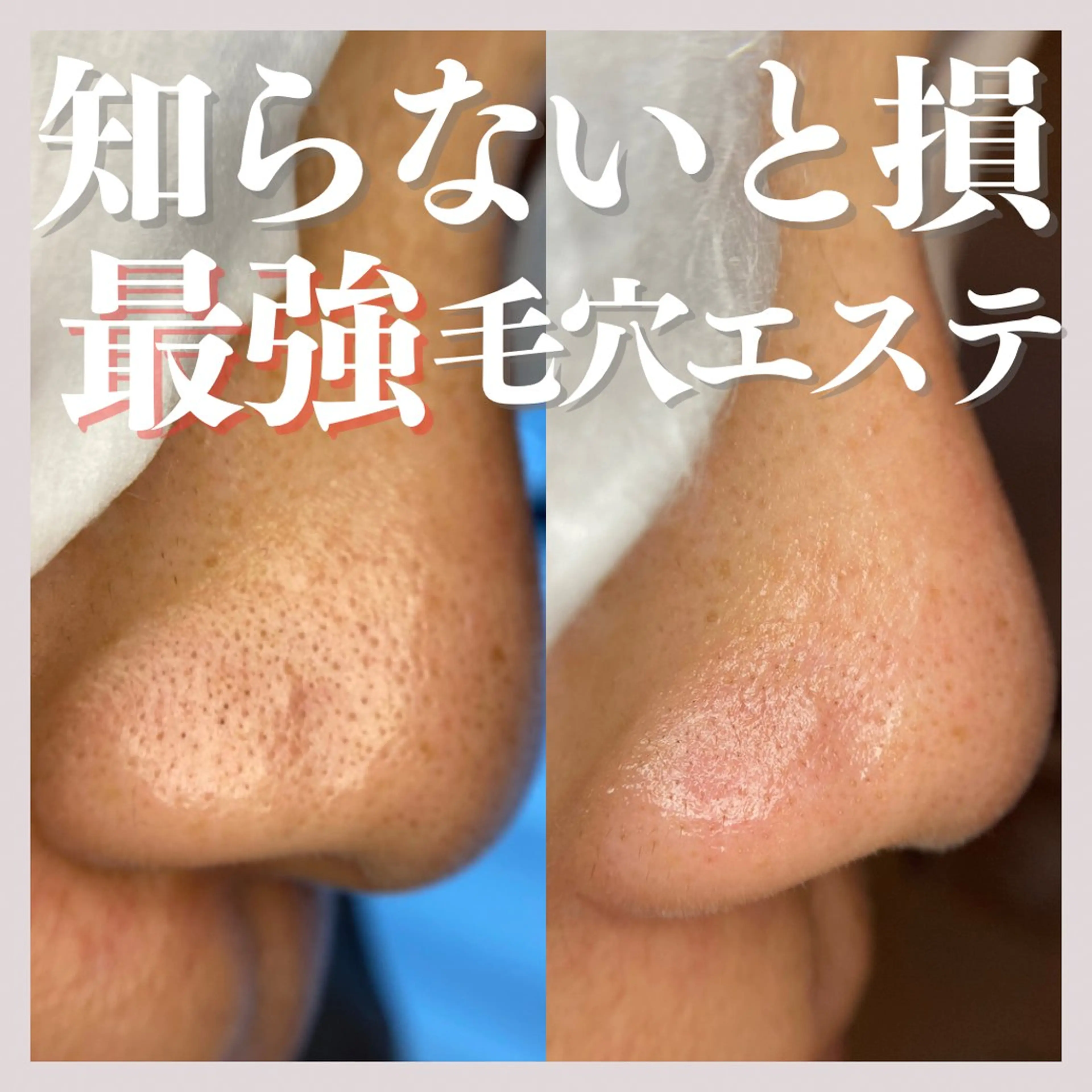 エステ salon MUSUBUのエステ・リラクイメージ