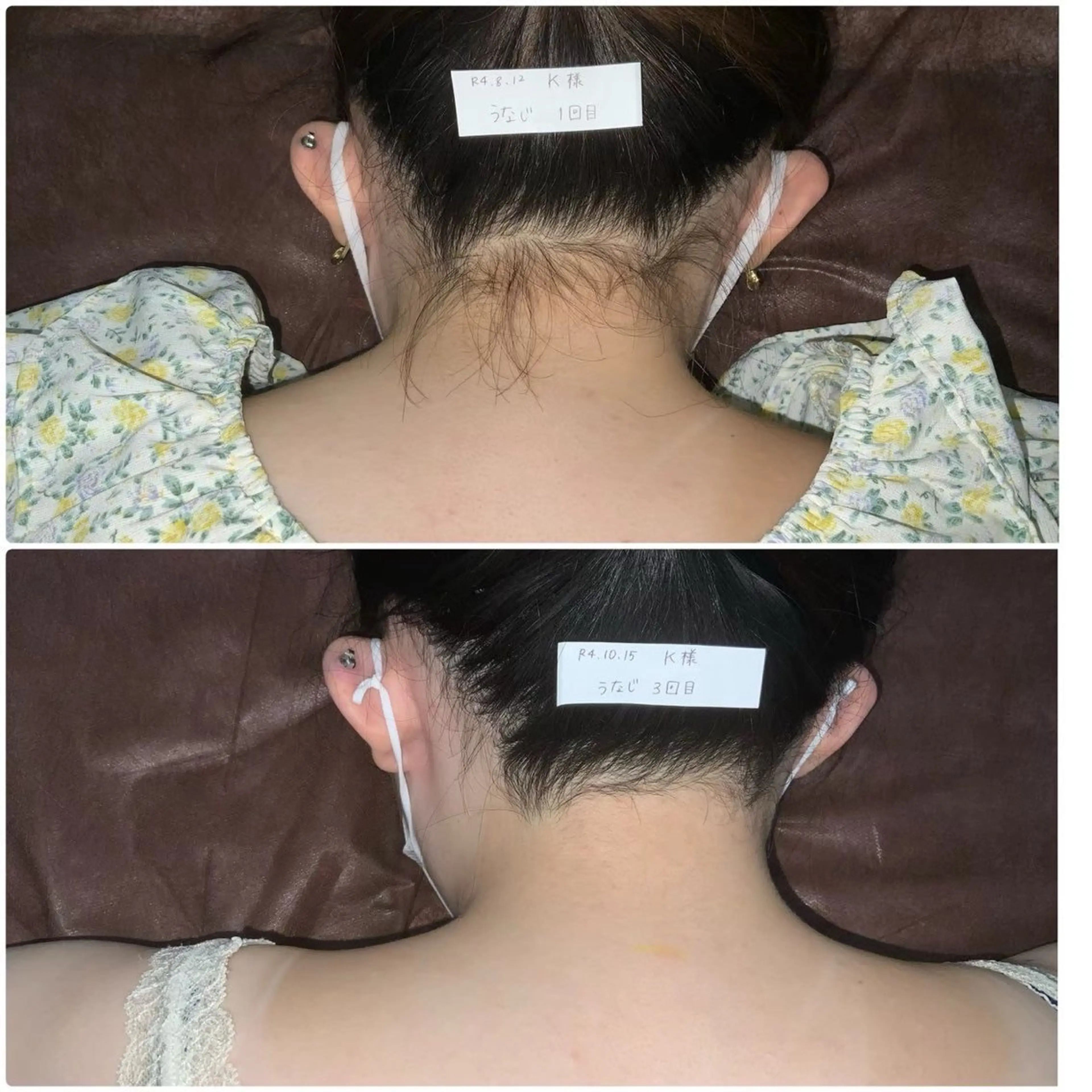 【お好きな部位を1箇所3回🌸】当店の脱毛は痛みもなくお肌が敏感な方も◎純国産機取り扱いサロン♪シェービング代無料✨の写真