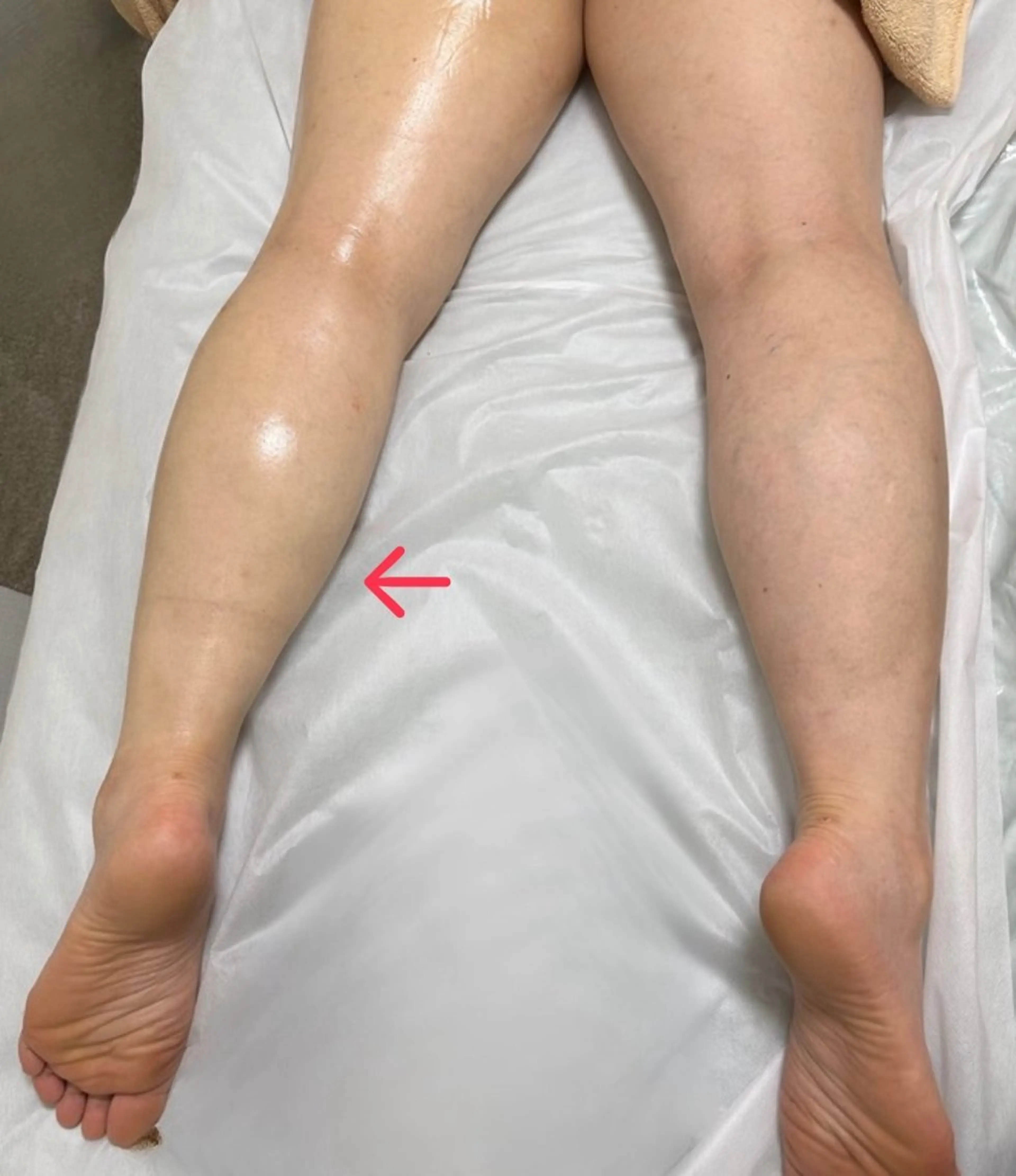 夏までに！ -5kgチャレンジのエステ・リラクイメージ