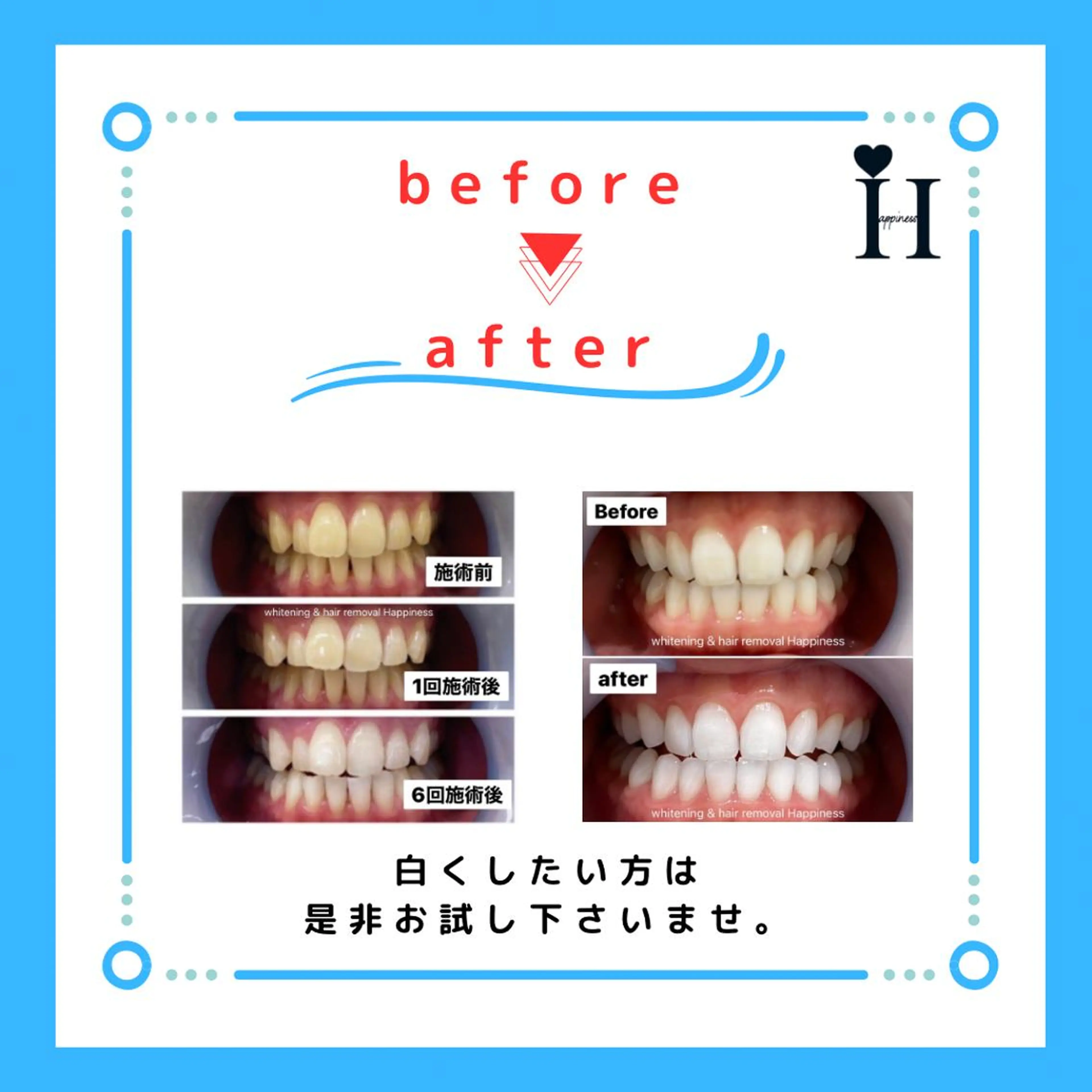 Happiness 心斎橋アメ村本店のその他イメージ