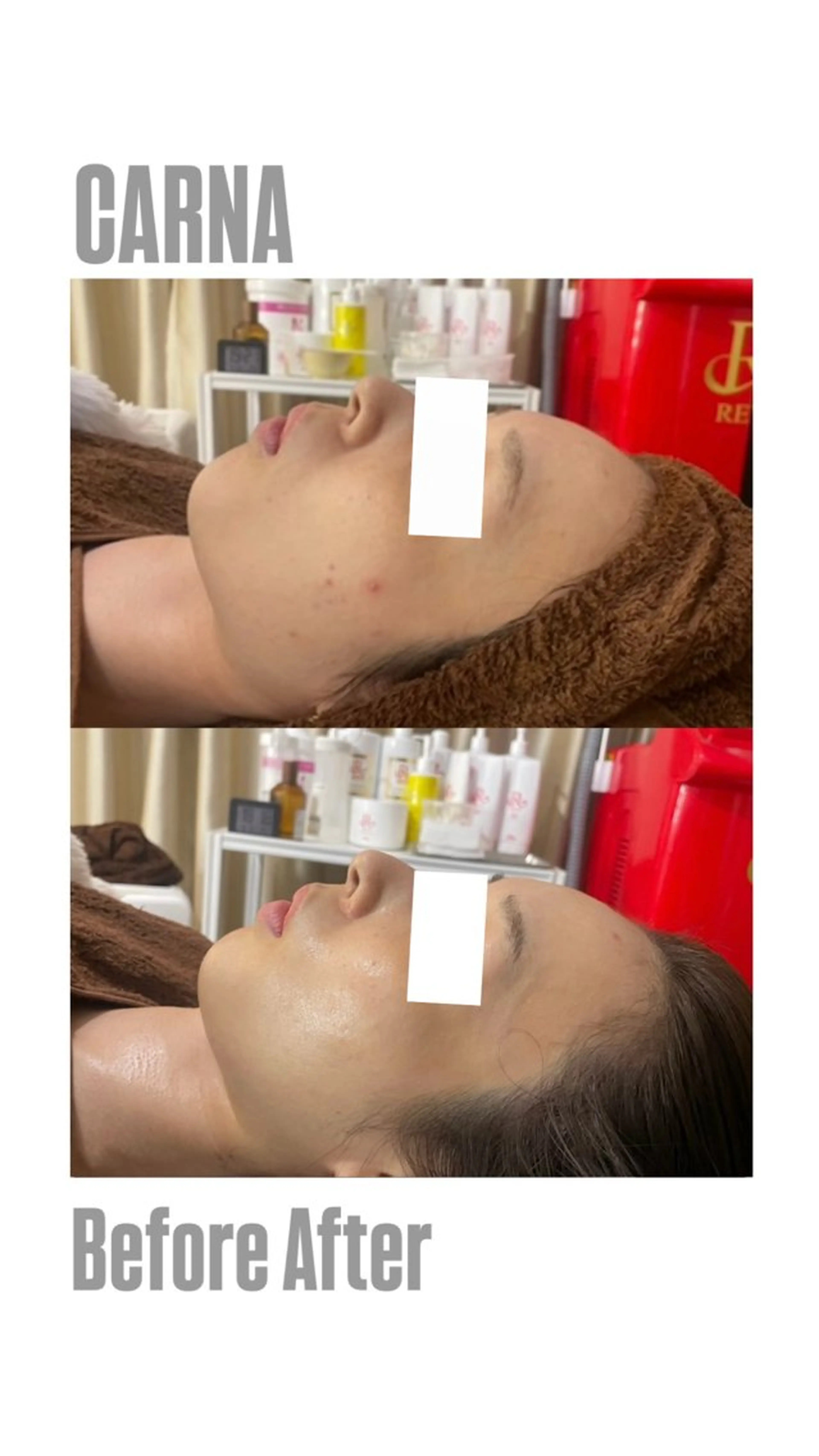 CARNA所属・【肌質改善専門店】 CARNAのエステ・リラクイメージ