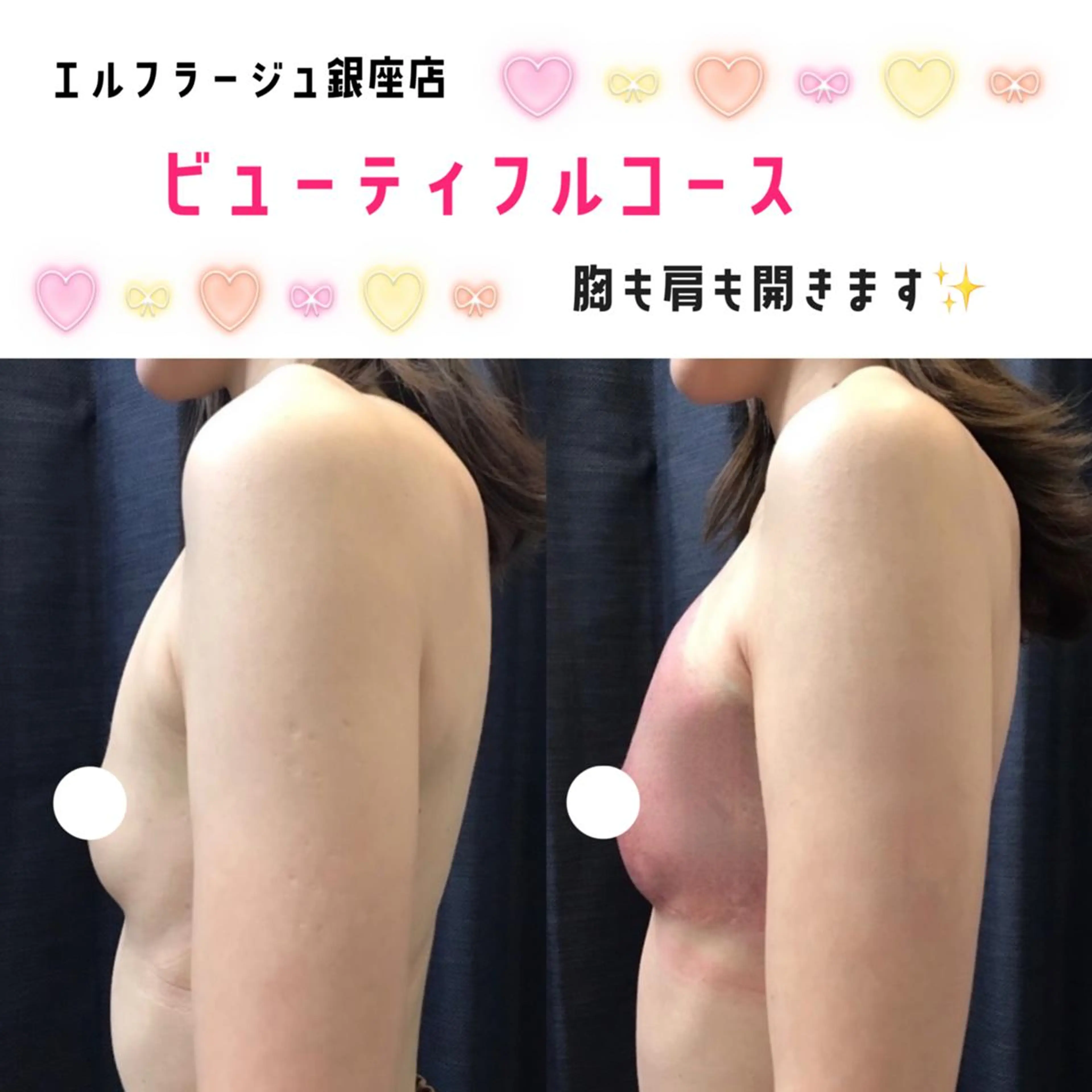 エルフラージュ 銀座店のエステ・リラクイメージ